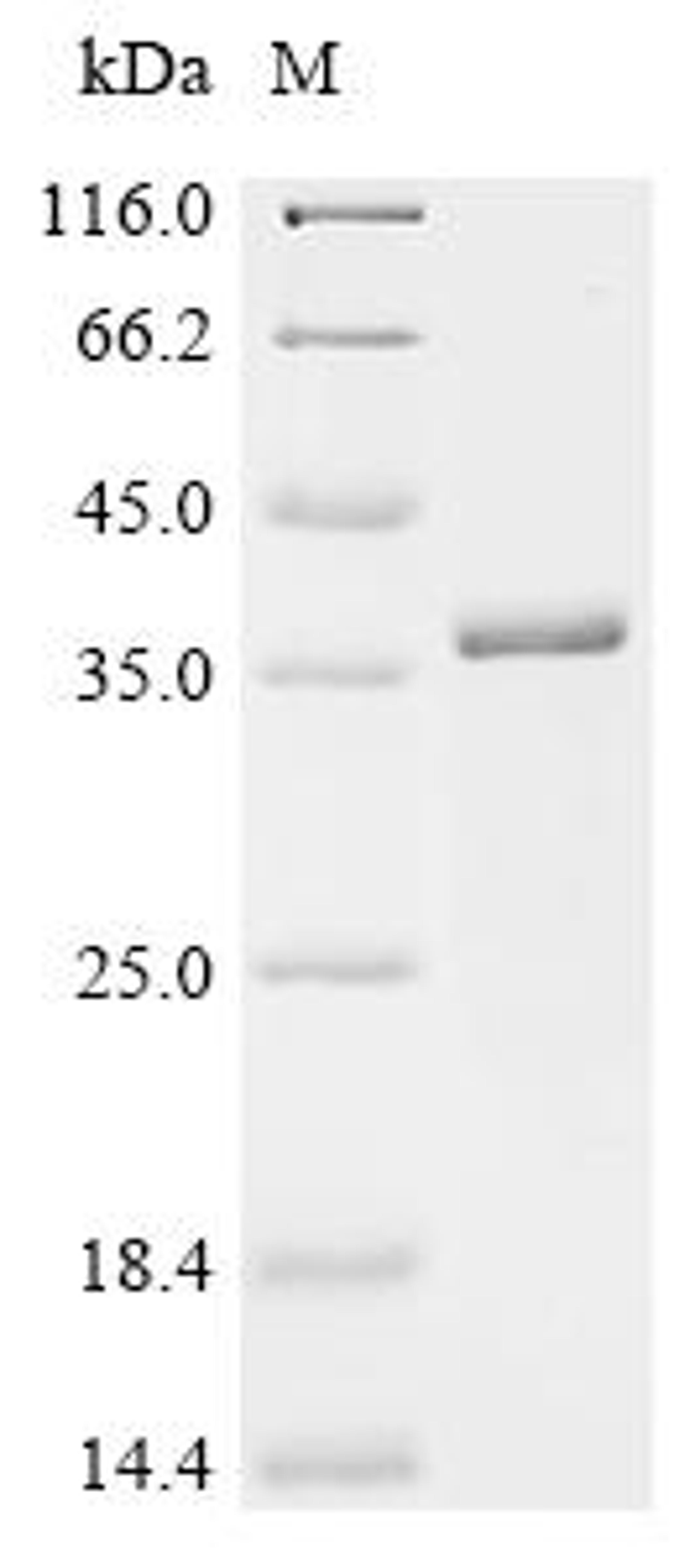 (Tris-Glycine gel) Discontinuous SDS-PAGE (reduced) with 5% enrichment gel and 15% separation gel.