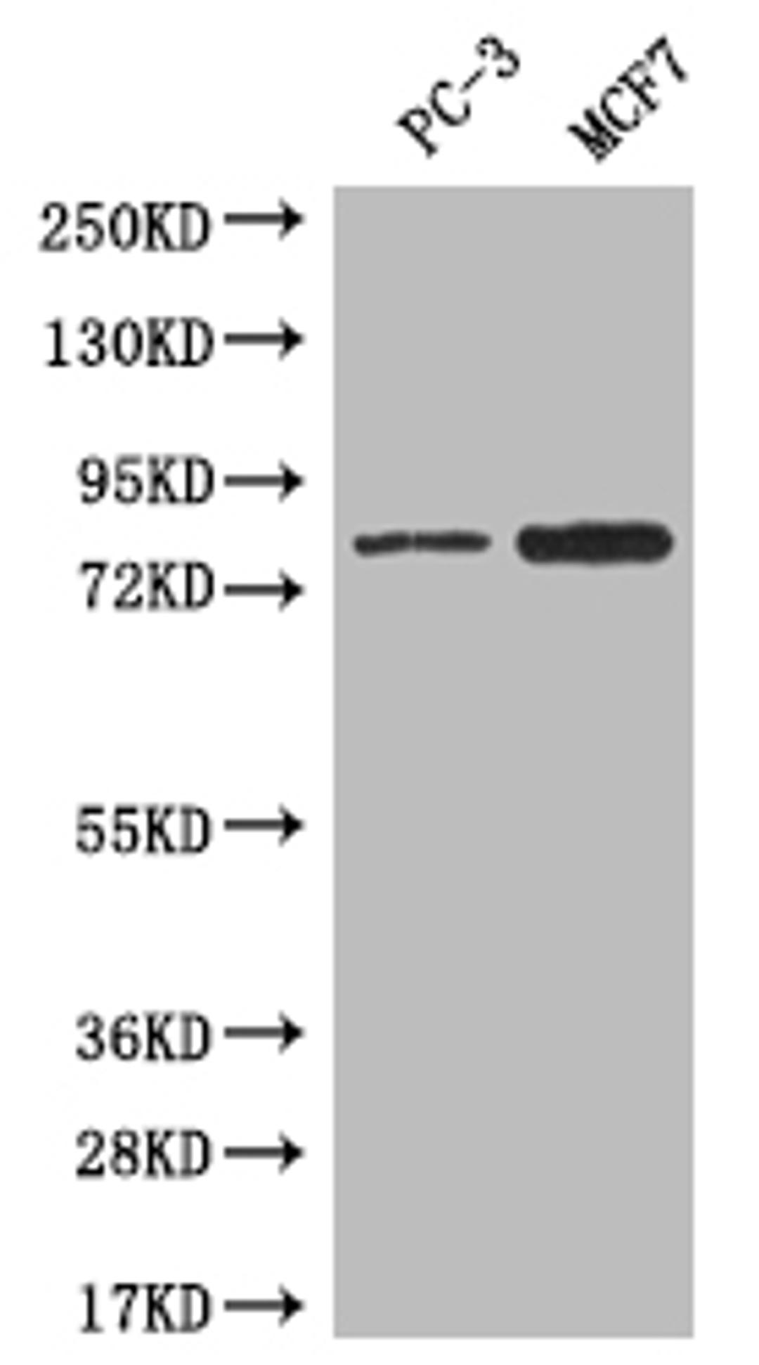 Western blot. All lanes: LRRN3 antibody at 0.5ug/ml + Mouse liver tissue. Secondary. Goat polyclonal to rabbit IgG at 1/10000 dilution. Predicted band size: 79 kDa. Observed band size: 79 kDa. 