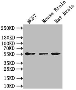 Western Blot. Positive WB detected in: MCF7 whole cell lysate,Mouse Brain tissue lysate,Rat Brain tissue lysate. All lanes: GFAP antibody at 1:1000. Secondary. Goat polyclonal to mouse IgG at 1/50000 dilution. Predicted band size: 50 kDa. Observed band size: 55 kDa. 
