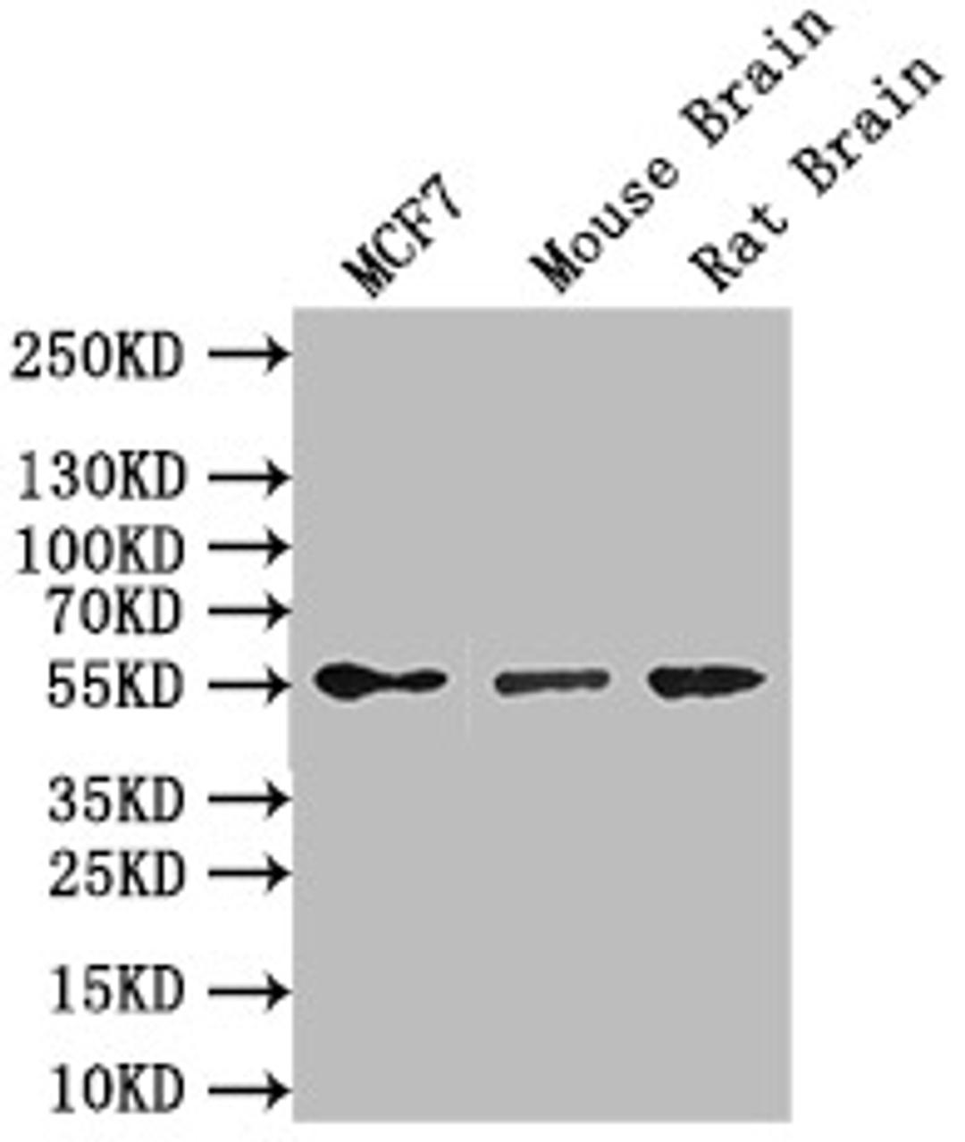 Western Blot. Positive WB detected in: MCF7 whole cell lysate,Mouse Brain tissue lysate,Rat Brain tissue lysate. All lanes: GFAP antibody at 1:1000. Secondary. Goat polyclonal to mouse IgG at 1/50000 dilution. Predicted band size: 50 kDa. Observed band size: 55 kDa.