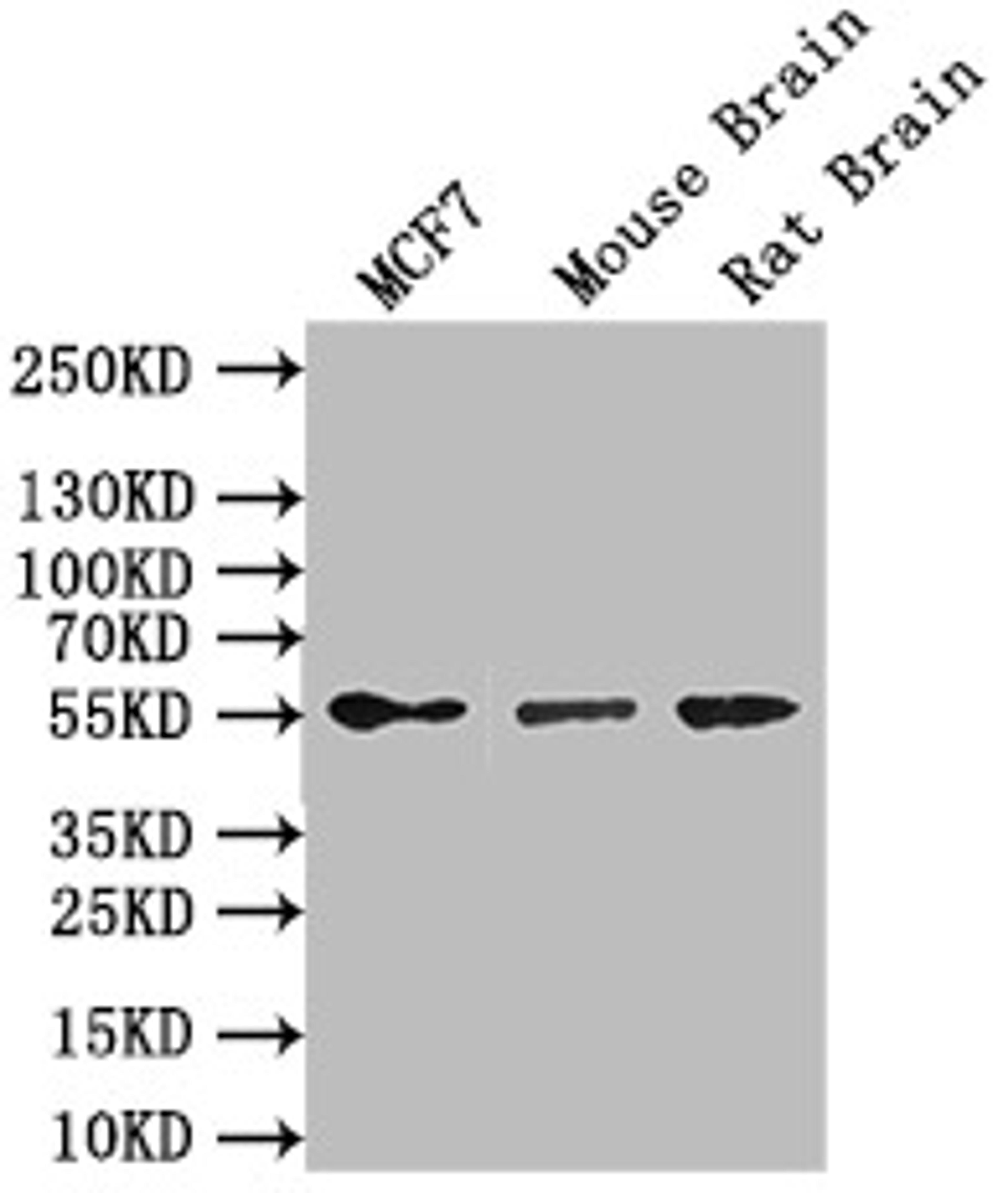 Western Blot. Positive WB detected in: MCF7 whole cell lysate,Mouse Brain tissue lysate,Rat Brain tissue lysate. All lanes: GFAP antibody at 1:1000. Secondary. Goat polyclonal to mouse IgG at 1/50000 dilution. Predicted band size: 50 kDa. Observed band size: 55 kDa.