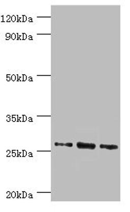 Western blot. All lanes: Azurocidin antibody at 1ug/ml. Lane 1: 293T whole cell lysate. Lane 2: Mouse spleen tissue. Lane 3: Mouse thymus tissue. Secondary. Goat polyclonal to rabbit IgG at 1/10000 dilution. Predicted band size: 27 kDa. Observed band size: 27 kDa. 