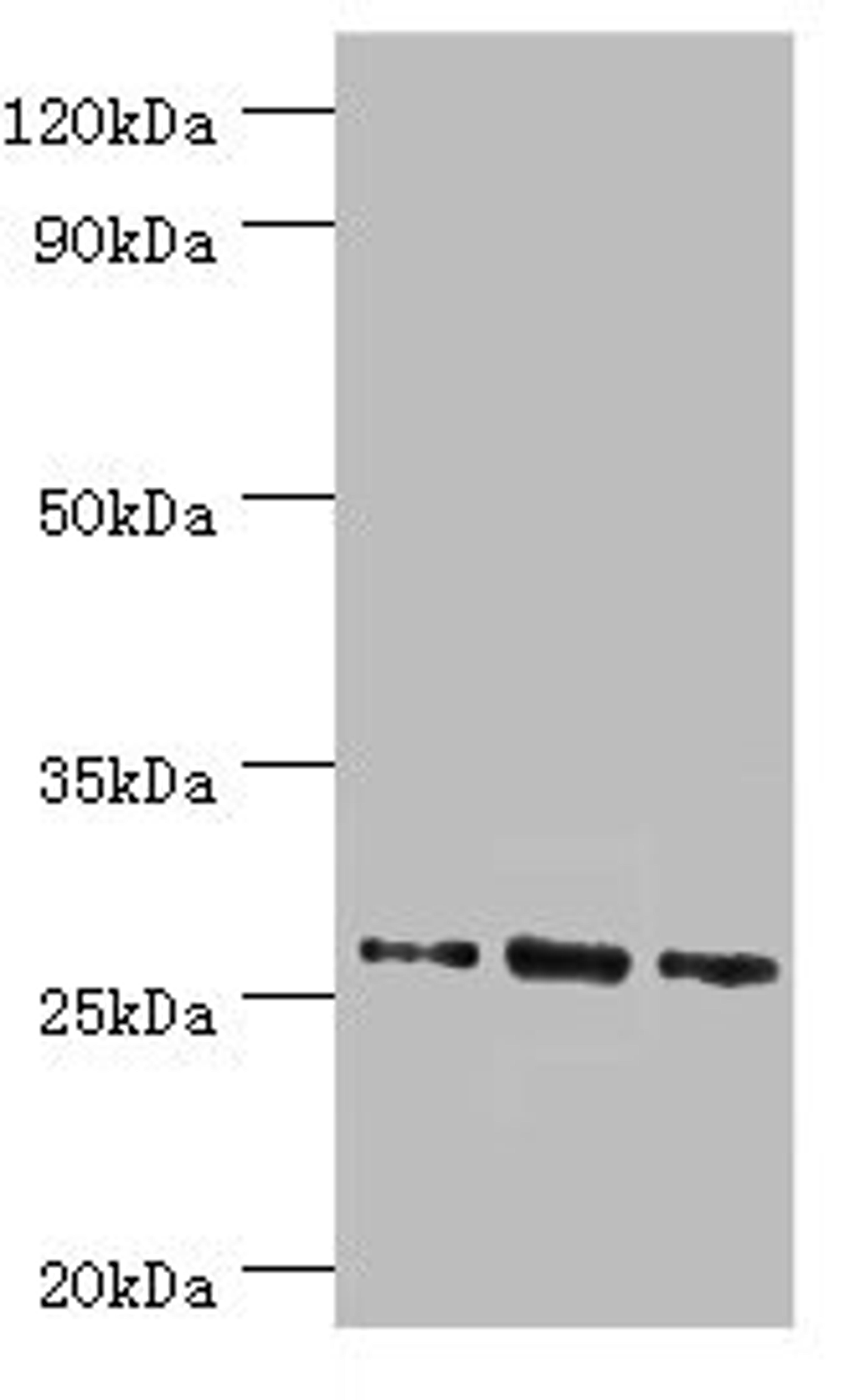 Western blot. All lanes: Azurocidin antibody at 1ug/ml. Lane 1: 293T whole cell lysate. Lane 2: Mouse spleen tissue. Lane 3: Mouse thymus tissue. Secondary. Goat polyclonal to rabbit IgG at 1/10000 dilution. Predicted band size: 27 kDa. Observed band size: 27 kDa. 