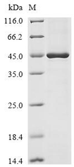 (Tris-Glycine gel) Discontinuous SDS-PAGE (reduced) with 5% enrichment gel and 15% separation gel.