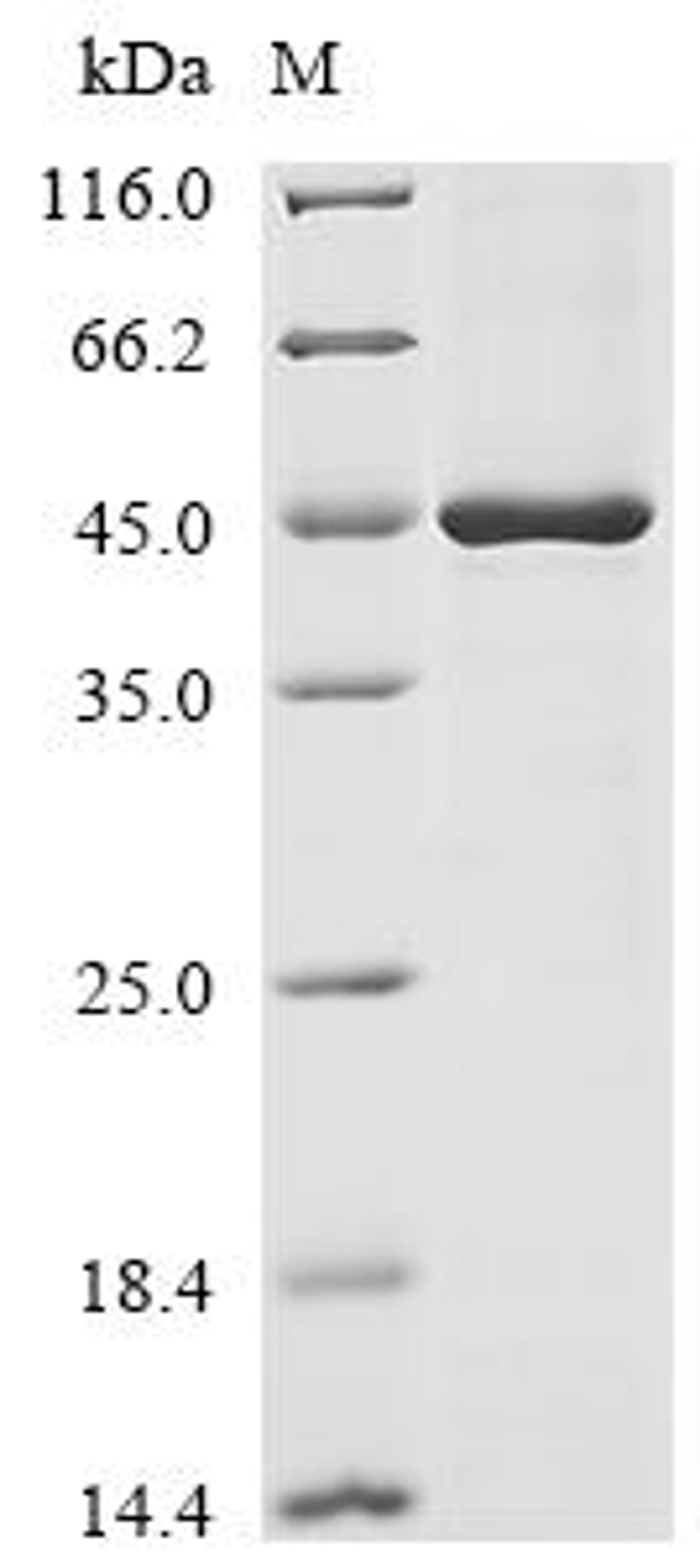 (Tris-Glycine gel) Discontinuous SDS-PAGE (reduced) with 5% enrichment gel and 15% separation gel.