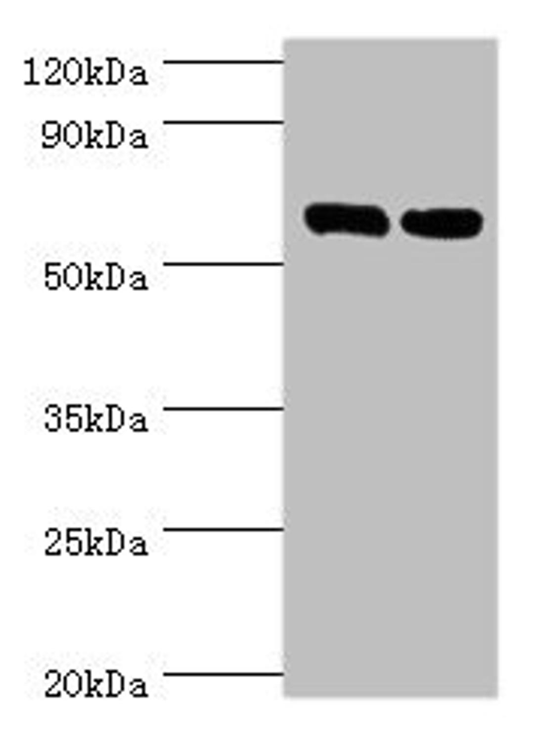 Western blot. All lanes: TROVE2 antibody at 2µg/ml. Lane 1: Hela whole cell lysate. Lane 2: 293T whole cell lysate. Secondary. Goat polyclonal to rabbit IgG at 1/10000 dilution. Predicted band size: 61, 24, 59, 60 kDa. Observed band size: 61 kDa