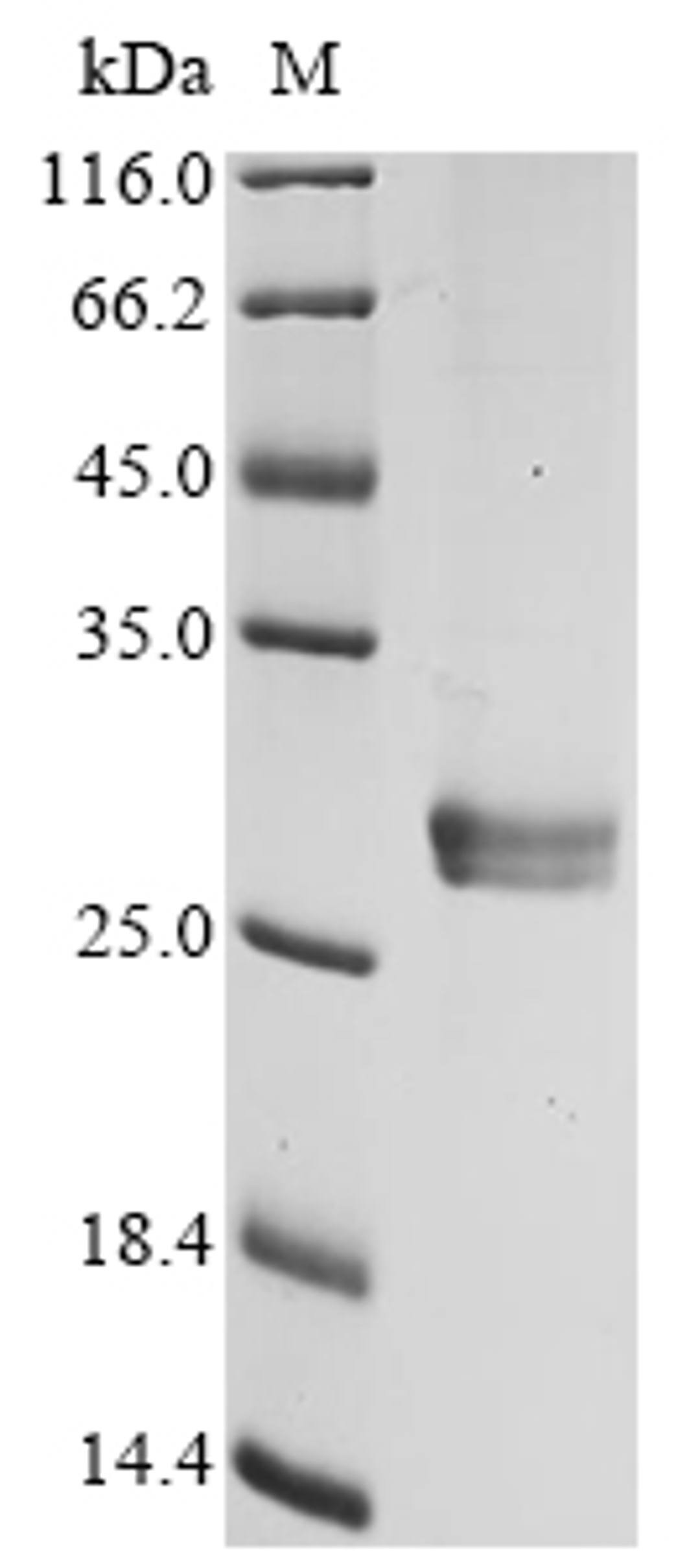 (Tris-Glycine gel) Discontinuous SDS-PAGE (reduced) with 5% enrichment gel and 15% separation gel.