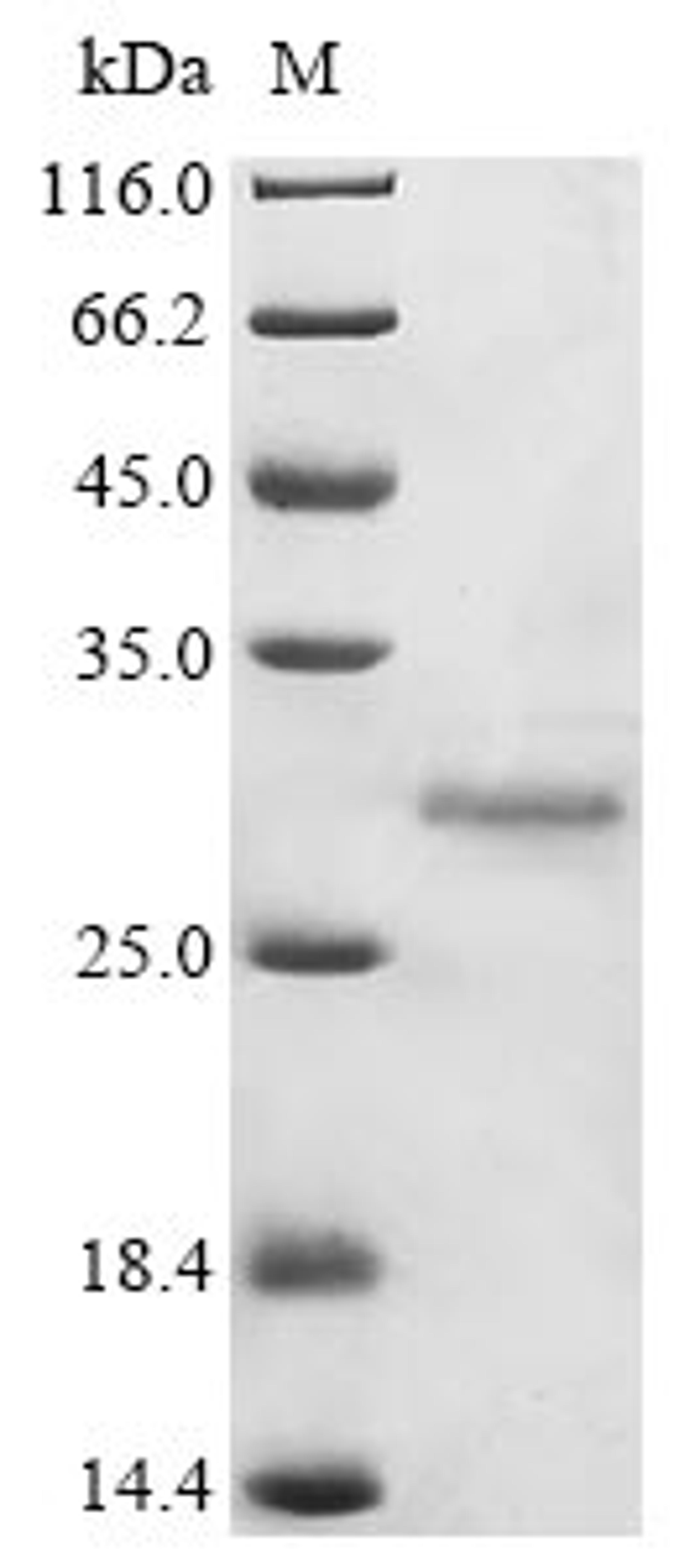 (Tris-Glycine gel) Discontinuous SDS-PAGE (reduced) with 5% enrichment gel and 15% separation gel.