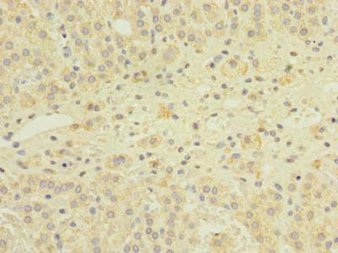 Immunohistochemistry of paraffin-embedded human adrenal gland tissue using CSB-PA873675LA01HU at dilution of 1:100