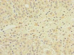 Immunohistochemistry of paraffin-embedded human adrenal gland tissue using CSB-PA873675LA01HU at dilution of 1:100