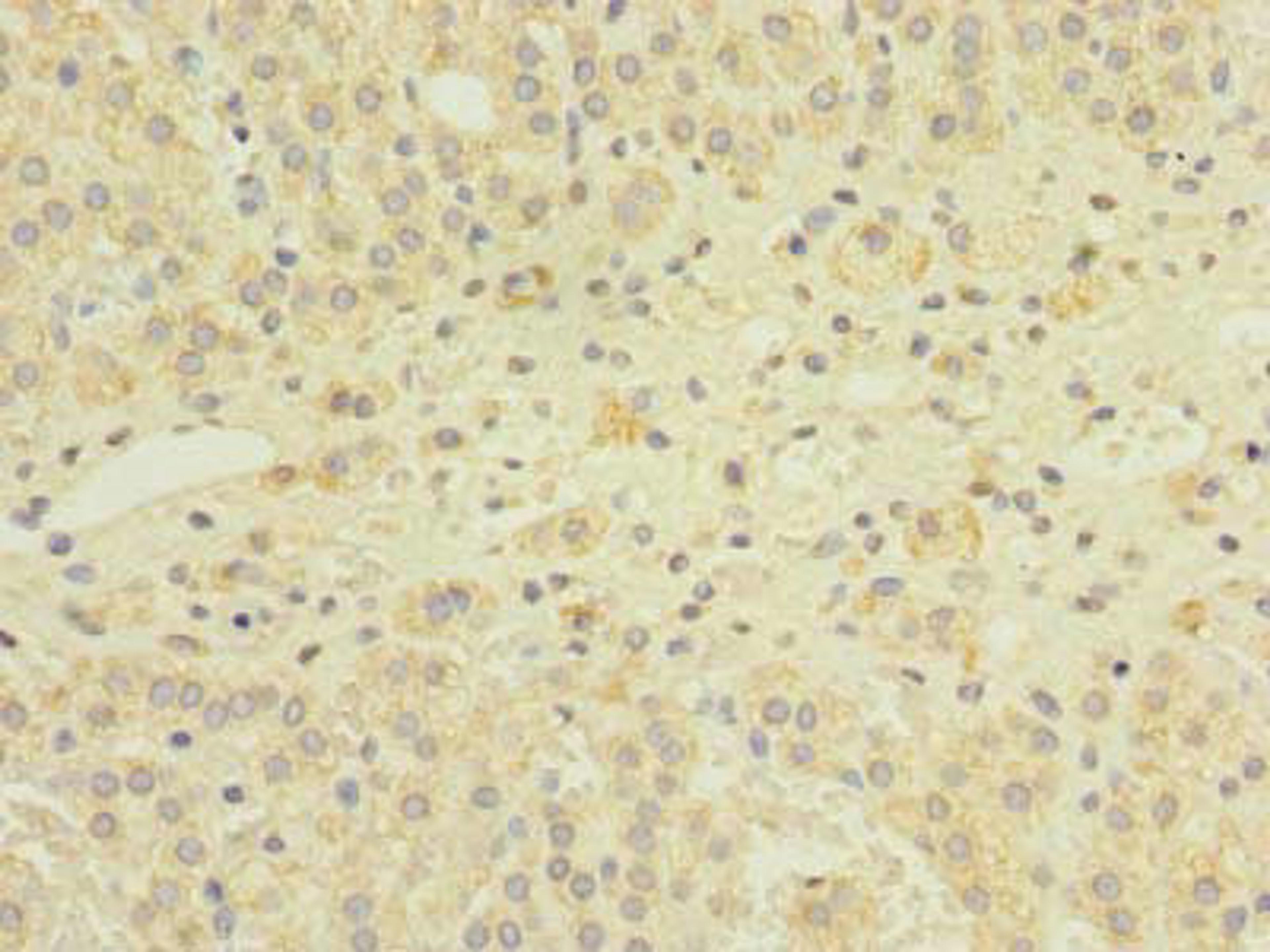 Immunohistochemistry of paraffin-embedded human adrenal gland tissue using CSB-PA873675LA01HU at dilution of 1:100