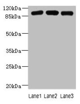 Western blot. All lanes: ASAP3 antibody at 1µg/ml. Lane 1: A549 whole cell lysate. Lane 2: MCF-7 whole cell lysate. Lane 3: K562 whole cell lysate. Secondary. Goat polyclonal to rabbit IgG at 1/10000 dilution. Predicted band size: 100, 44, 98 kDa. Observed band size: 100 kDa