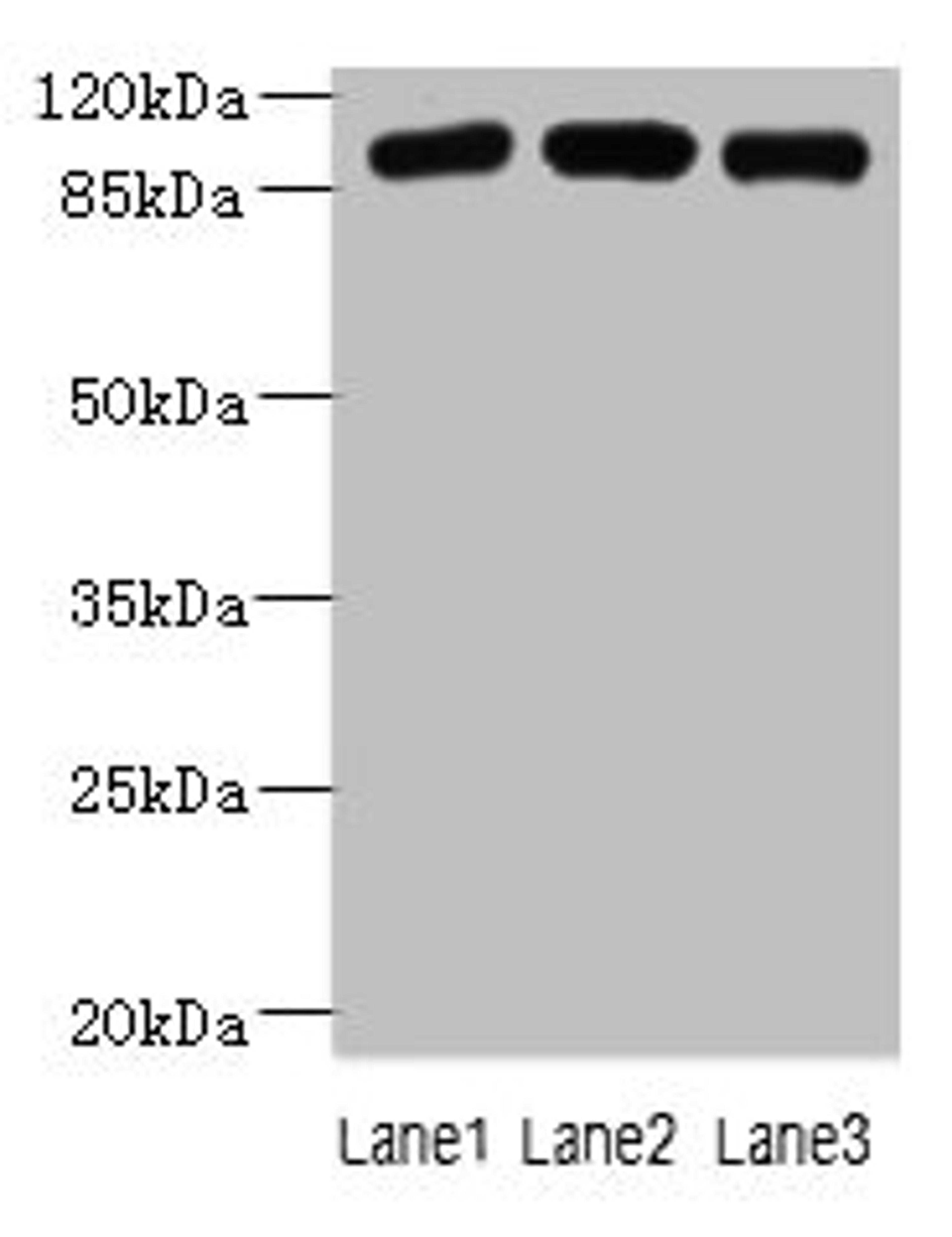 Western blot. All lanes: ASAP3 antibody at 1µg/ml. Lane 1: A549 whole cell lysate. Lane 2: MCF-7 whole cell lysate. Lane 3: K562 whole cell lysate. Secondary. Goat polyclonal to rabbit IgG at 1/10000 dilution. Predicted band size: 100, 44, 98 kDa. Observed band size: 100 kDa