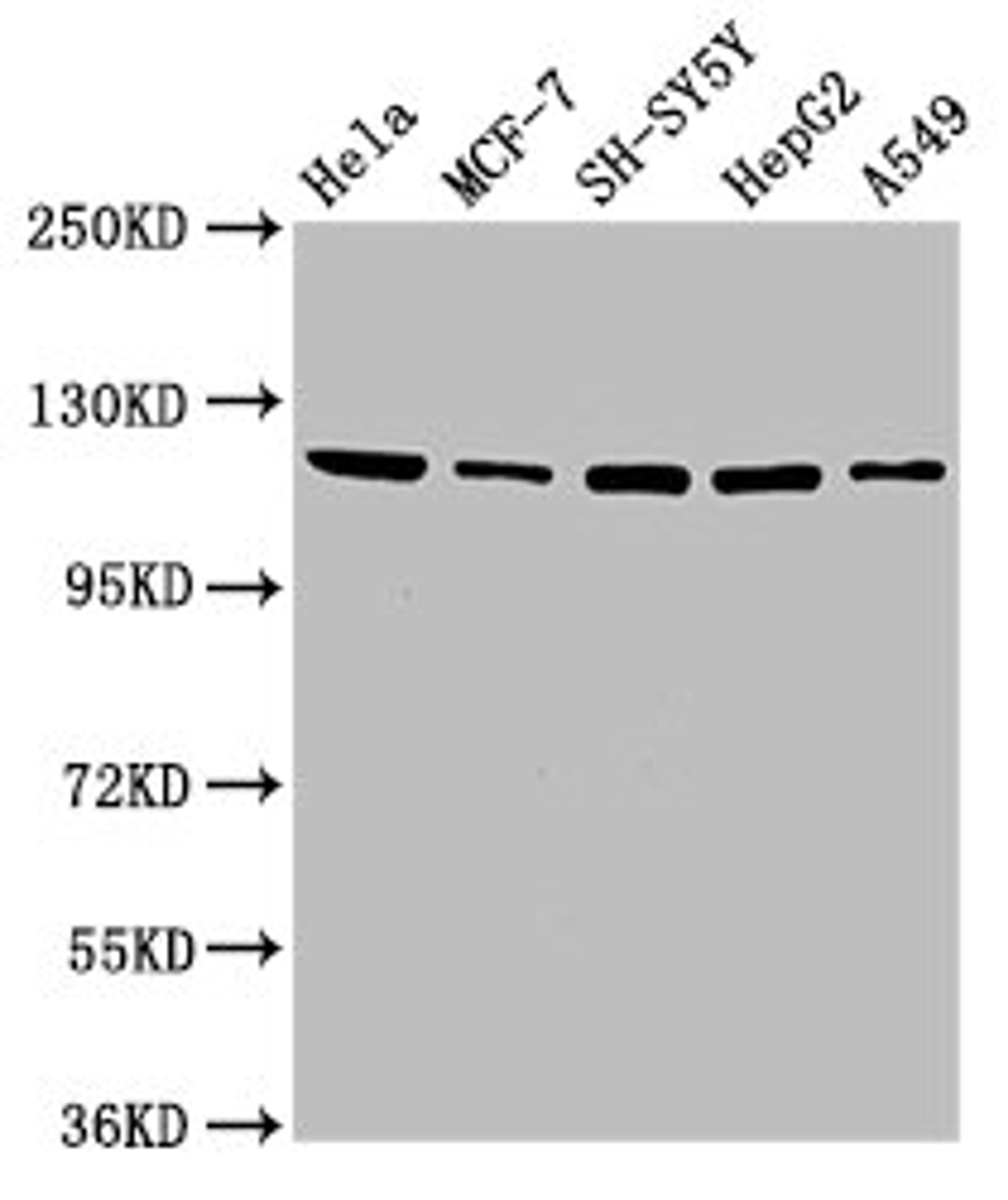 Western Blot. Positive WB detected in: Hela whole cell lysate, MCF-7 whole cell lysate, SH-SY5Y whole cell lysate, HepG2 whole cell lysate, A549 whole cell lysate. All lanes: USP48 antibody at 3.5ug/ml. Secondary. Goat polyclonal to rabbit IgG at 1/50000 dilution. Predicted band size: 120, 113, 82, 46, 60, 18, 57, 121 kDa. Observed band size: 120 kDa