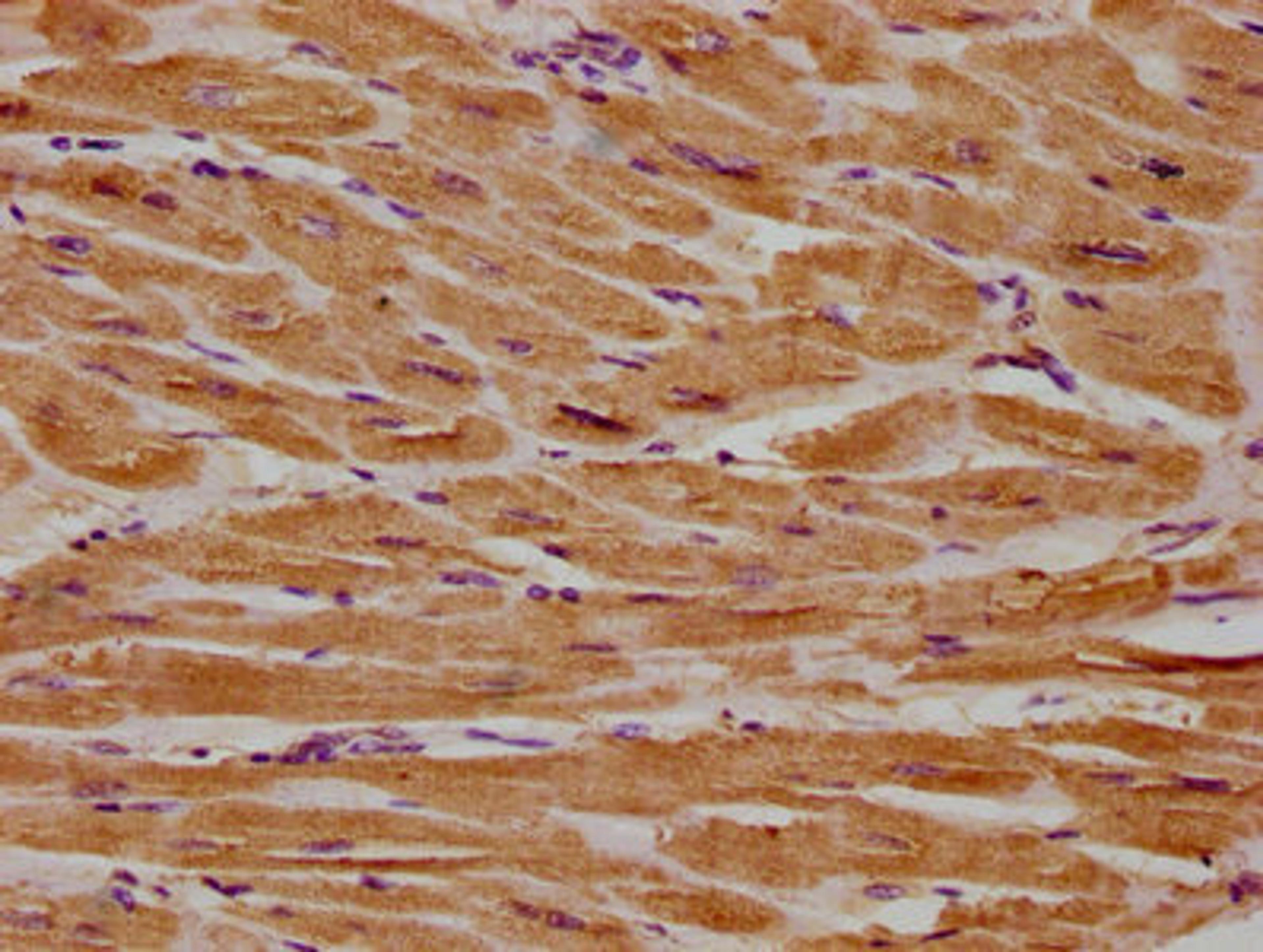 IHC image of CSB-PA860321LA01HU diluted at 1:300 and staining in paraffin-embedded human heart tissue performed on a Leica BondTM system. After dewaxing and hydration, antigen retrieval was mediated by high pressure in a citrate buffer (pH 6.0). Section was blocked with 10% normal goat serum 30min at RT. Then primary antibody (1% BSA) was incubated at 4°C overnight. The primary is detected by a biotinylated secondary antibody and visualized using an HRP conjugated SP system.