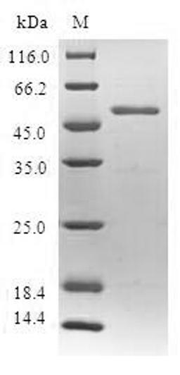 (Tris-Glycine gel) Discontinuous SDS-PAGE (reduced) with 5% enrichment gel and 15% separation gel.