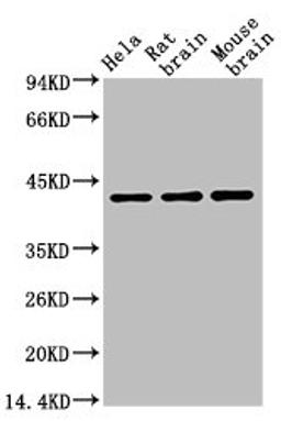 Western blot analysis of Hela (1), Rat brain (2), Mouse brain (3), (A02) diluted at 1:10000.