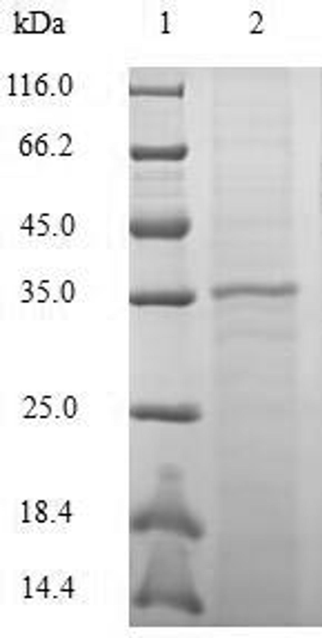(Tris-Glycine gel) Discontinuous SDS-PAGE (reduced) with 5% enrichment gel and 15% separation gel.