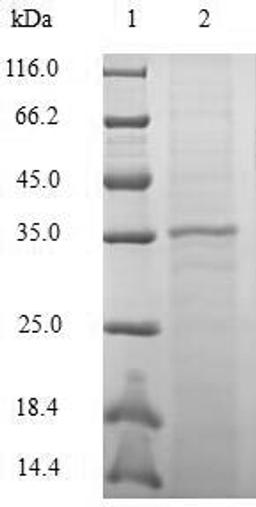 (Tris-Glycine gel) Discontinuous SDS-PAGE (reduced) with 5% enrichment gel and 15% separation gel.