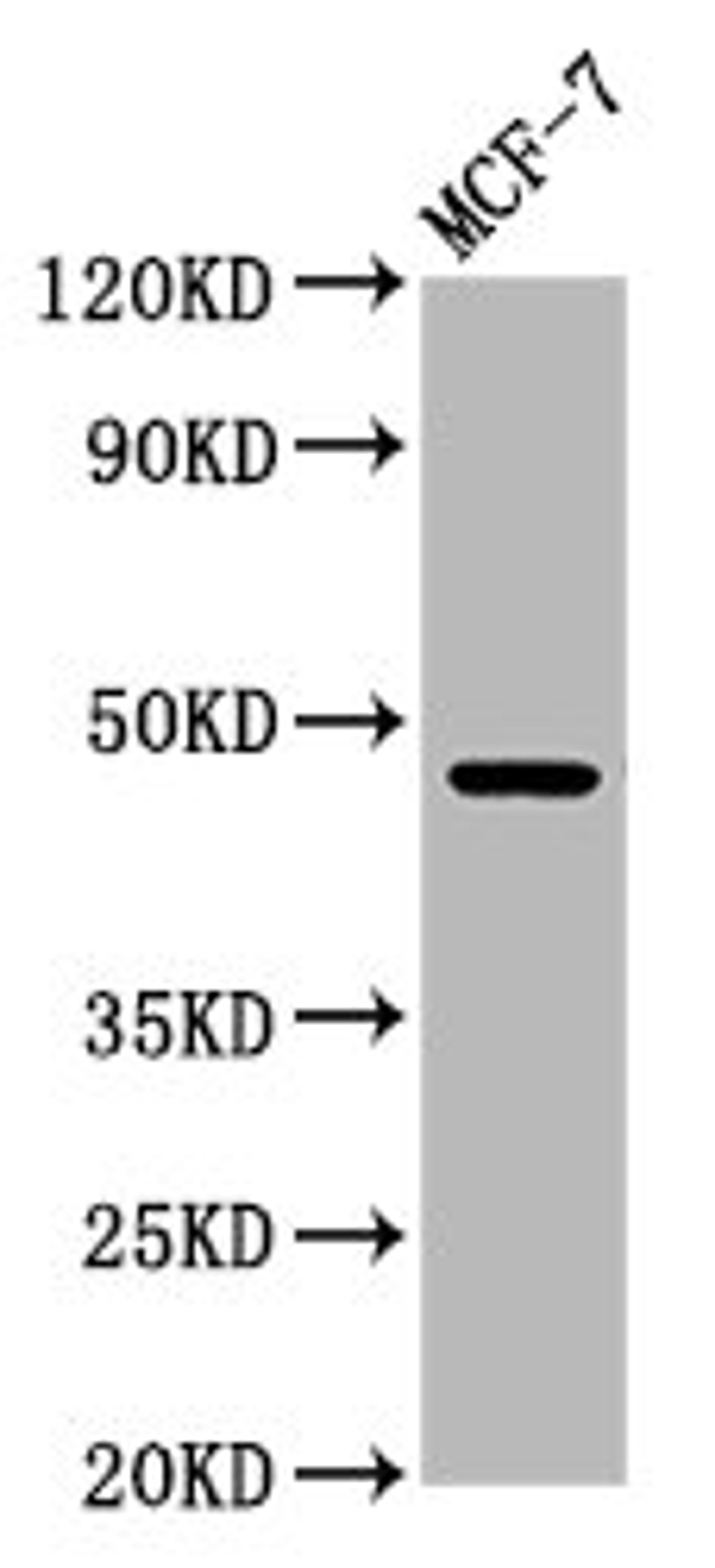 Western Blot. Positive WB detected in: MCF-7 whole cell lysate. All lanes: WDFY2 antibody at 5.6µg/ml. Secondary. Goat polyclonal to rabbit IgG at 1/50000 dilution. Predicted band size: 46 kDa. Observed band size: 46 kDa