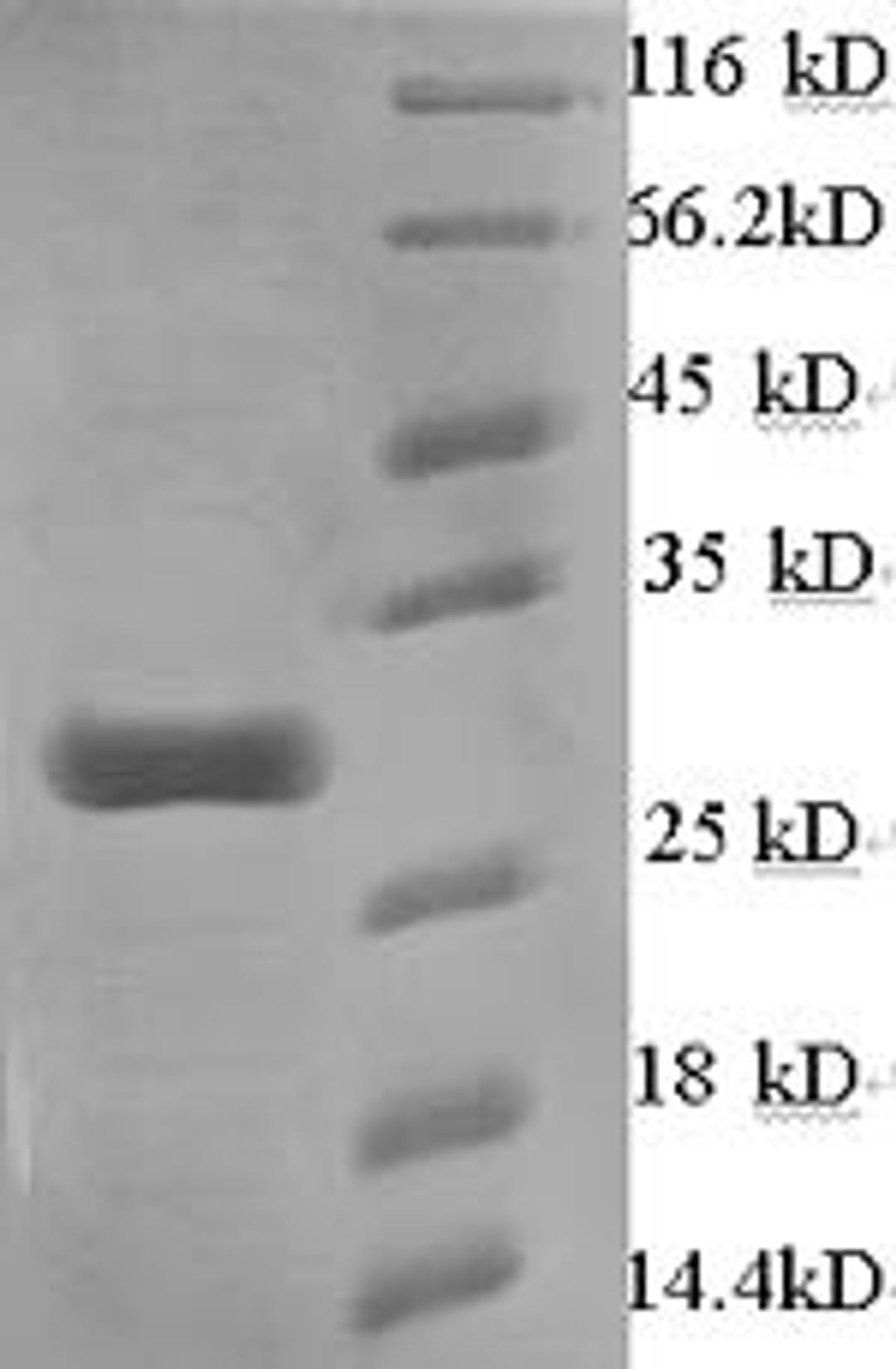 (Tris-Glycine gel) Discontinuous SDS-PAGE (reduced) with 5% enrichment gel and 15% separation gel.