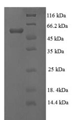 (Tris-Glycine gel) Discontinuous SDS-PAGE (reduced) with 5% enrichment gel and 15% separation gel.