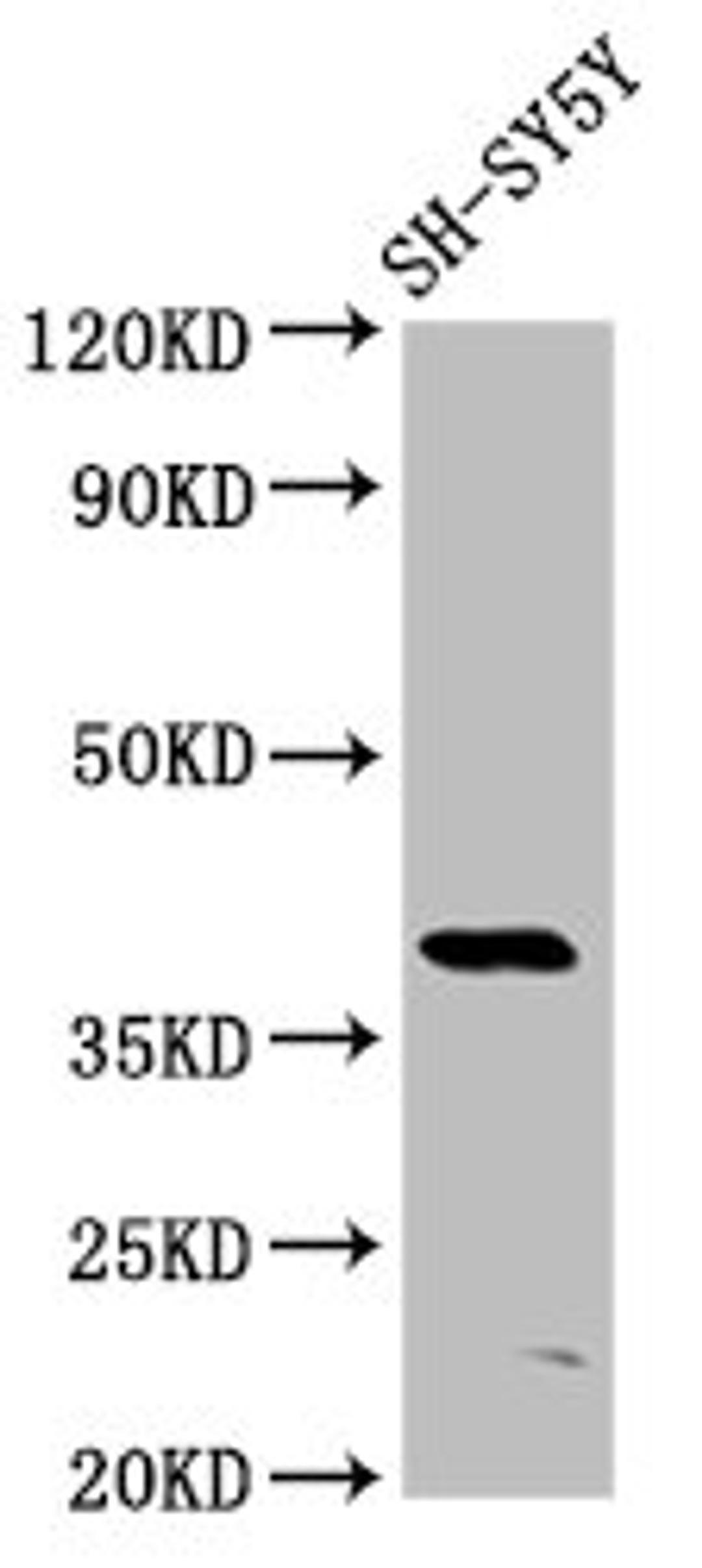 Western Blot. Positive WB detected in: SH-SY5Y whole cell lysate. All lanes: MKX antibody at 6µg/ml. Secondary. Goat polyclonal to rabbit IgG at 1/50000 dilution. Predicted band size: 40 kDa. Observed band size: 40 kDa