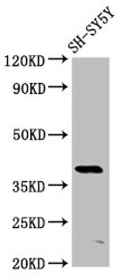 Western Blot. Positive WB detected in: SH-SY5Y whole cell lysate. All lanes: MKX antibody at 6µg/ml. Secondary. Goat polyclonal to rabbit IgG at 1/50000 dilution. Predicted band size: 40 kDa. Observed band size: 40 kDa