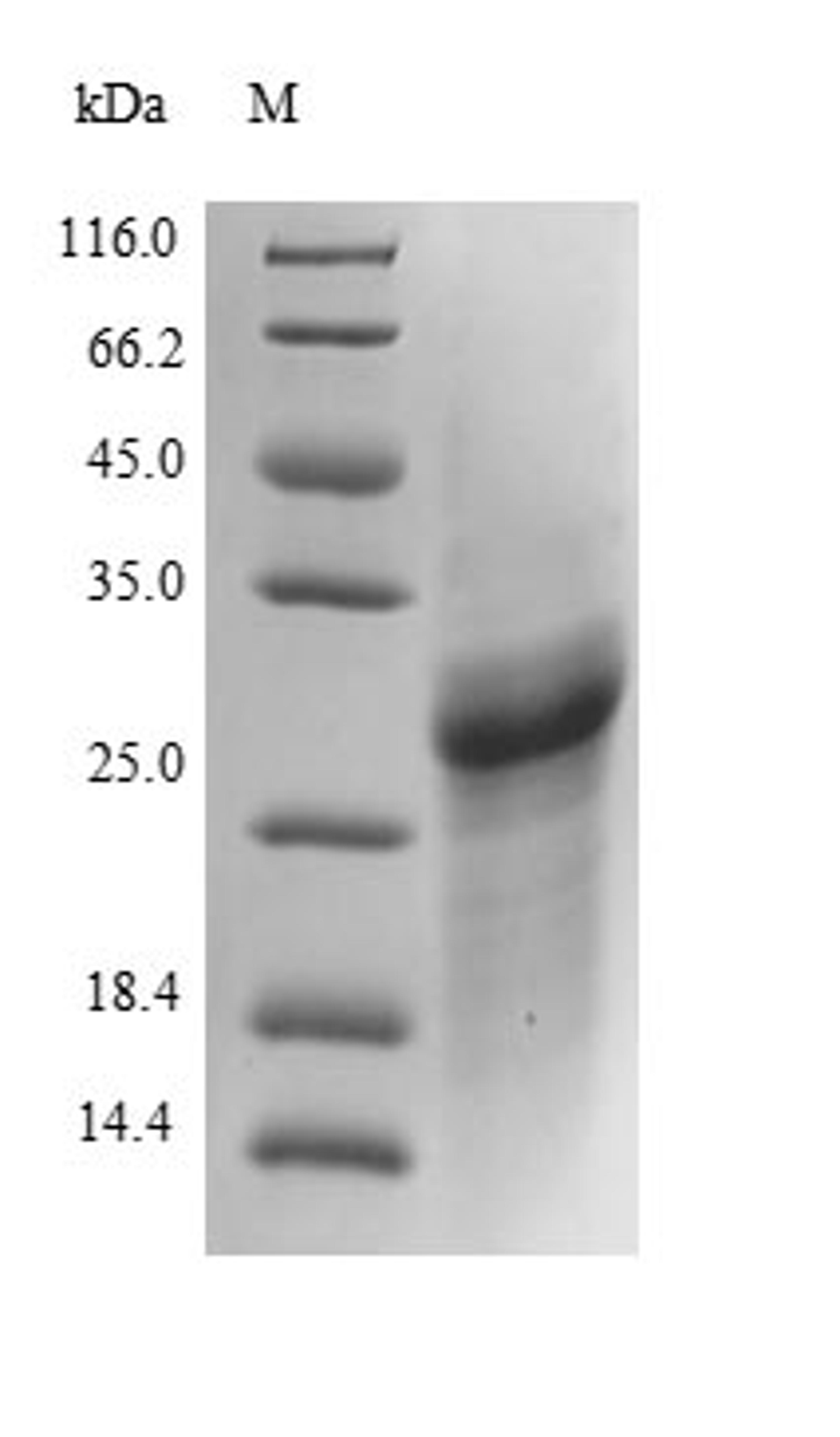 (Tris-Glycine gel) Discontinuous SDS-PAGE (reduced) with 5% enrichment gel and 15% separation gel.