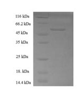 (Tris-Glycine gel) Discontinuous SDS-PAGE (reduced) with 5% enrichment gel and 15% separation gel.
