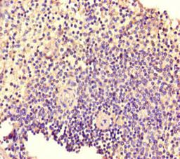 Immunohistochemistry of paraffin-embedded human spleen tissue using CSB-PA614387LA01HU at dilution of 1:100
