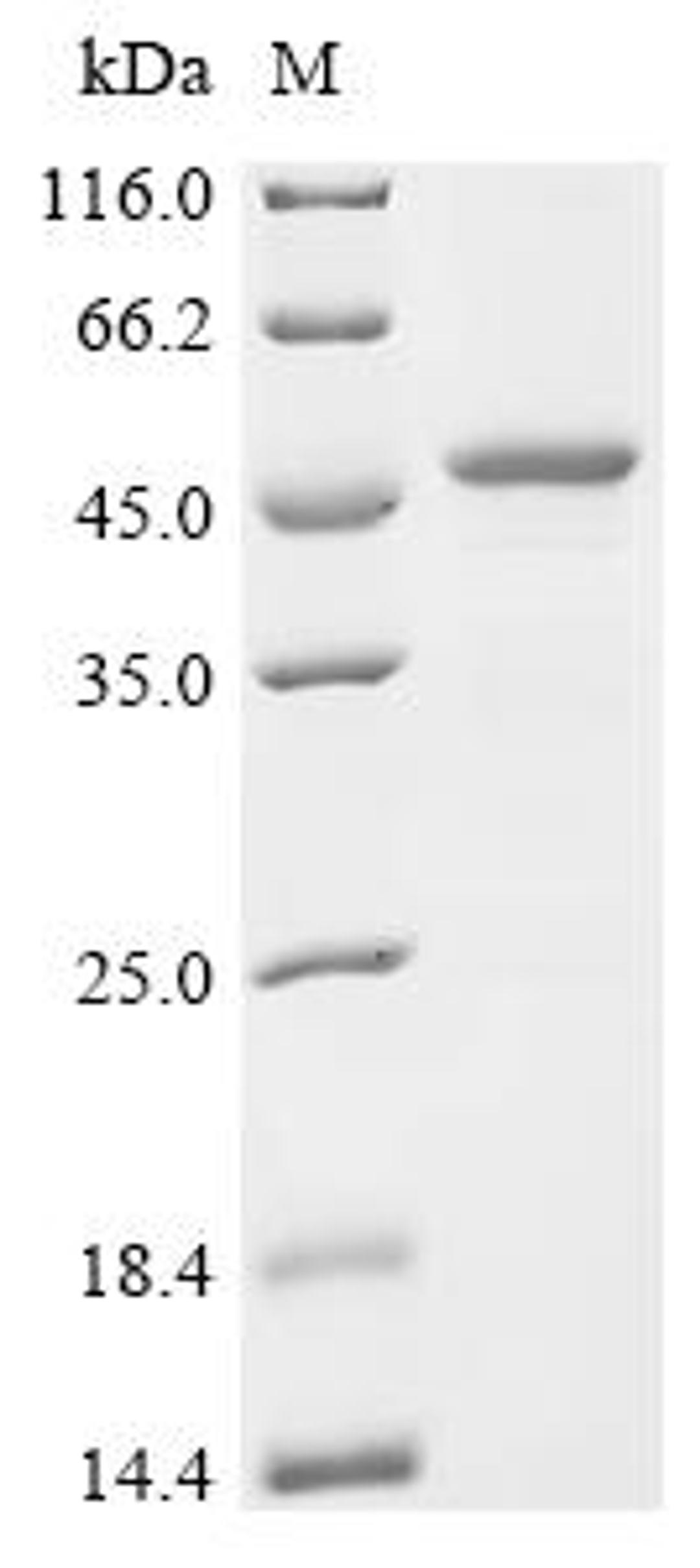 (Tris-Glycine gel) Discontinuous SDS-PAGE (reduced) with 5% enrichment gel and 15% separation gel.