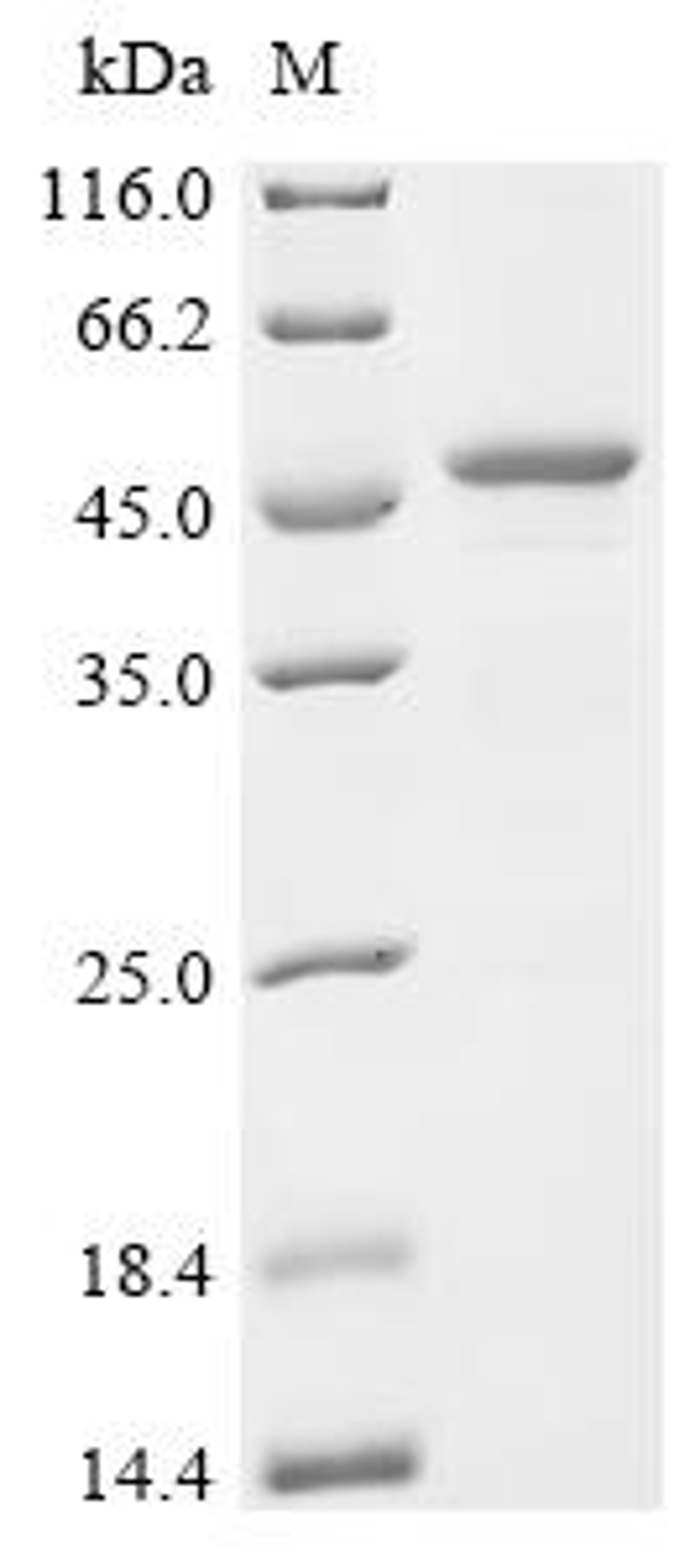 (Tris-Glycine gel) Discontinuous SDS-PAGE (reduced) with 5% enrichment gel and 15% separation gel.