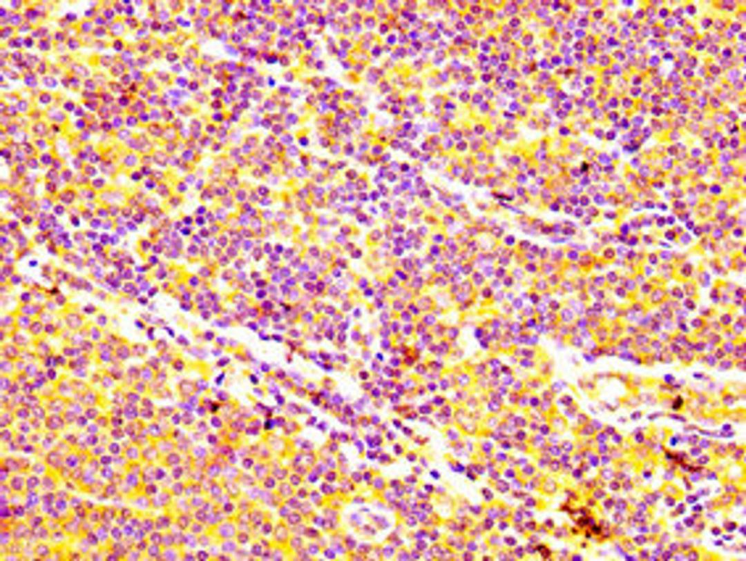 IHC image of CSB-PA001064LA01HU diluted at 1:400 and staining in paraffin-embedded human lymph node tissue performed on a Leica BondTM system. After dewaxing and hydration, antigen retrieval was mediated by high pressure in a citrate buffer (pH 6.0). Section was blocked with 10% normal goat serum 30min at RT. Then primary antibody (1% BSA) was incubated at 4&deg;C overnight. The primary is detected by a biotinylated secondary antibody and visualized using an HRP conjugated SP system.