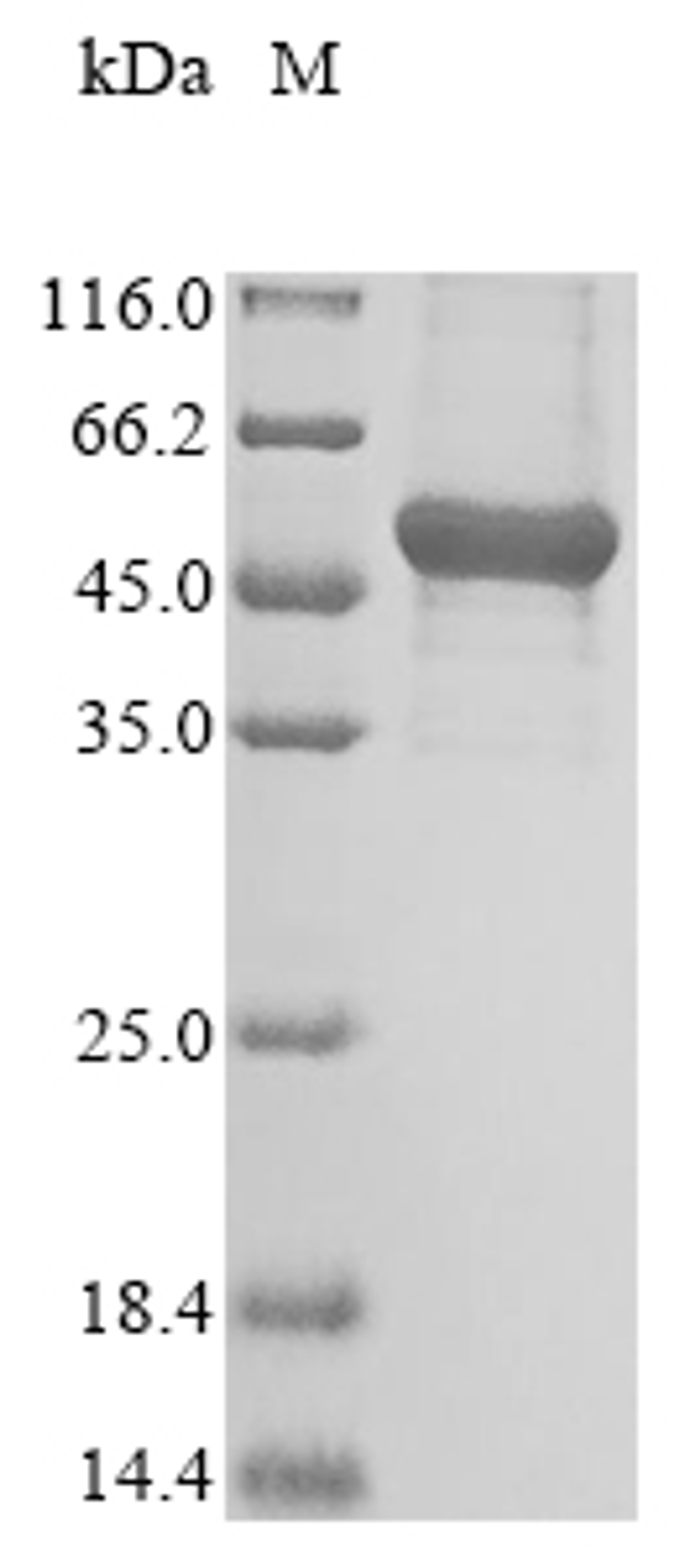 (Tris-Glycine gel) Discontinuous SDS-PAGE (reduced) with 5% enrichment gel and 15% separation gel.