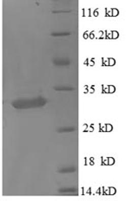 (Tris-Glycine gel) Discontinuous SDS-PAGE (reduced) with 5% enrichment gel and 15% separation gel.