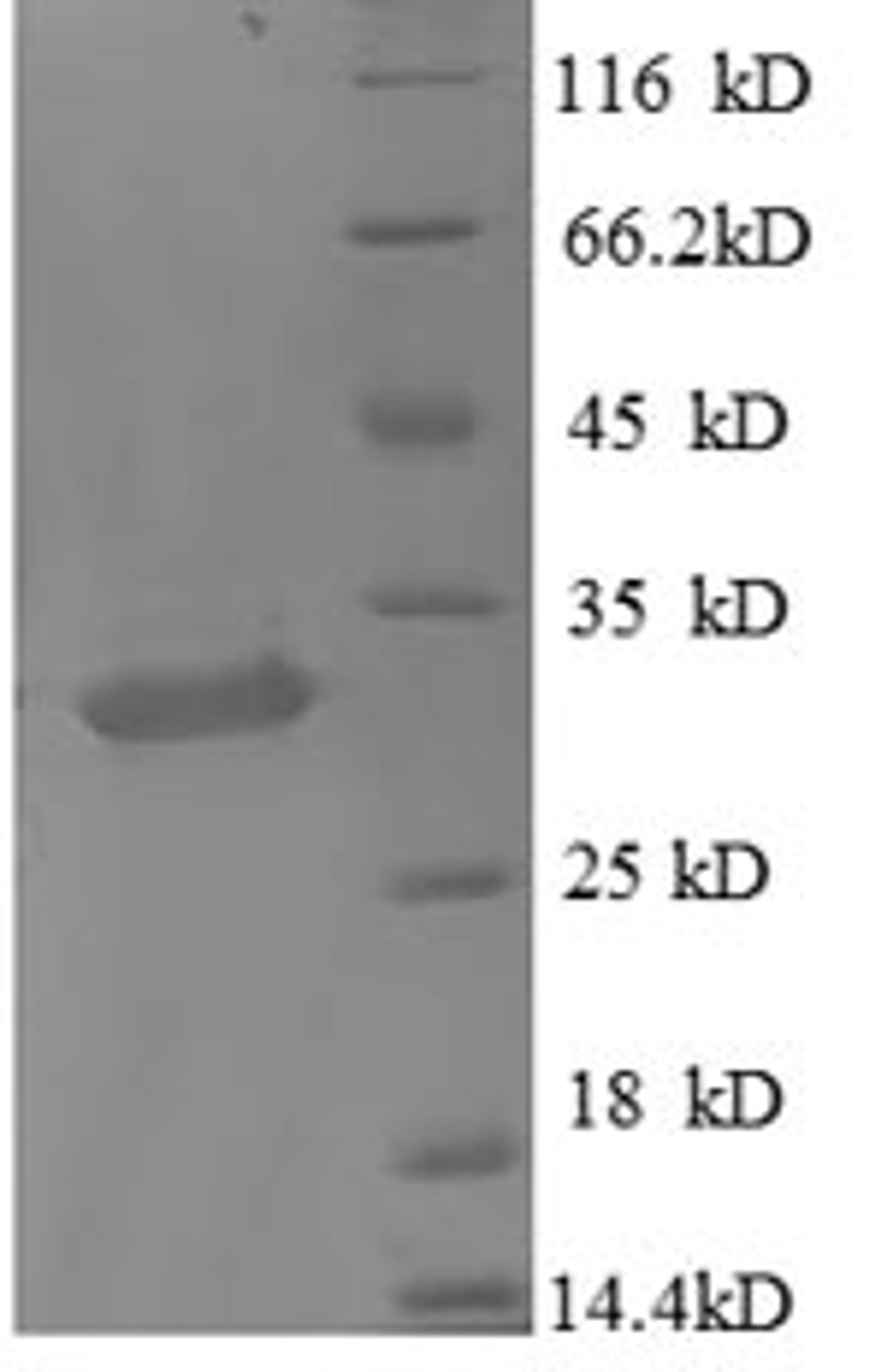 (Tris-Glycine gel) Discontinuous SDS-PAGE (reduced) with 5% enrichment gel and 15% separation gel.