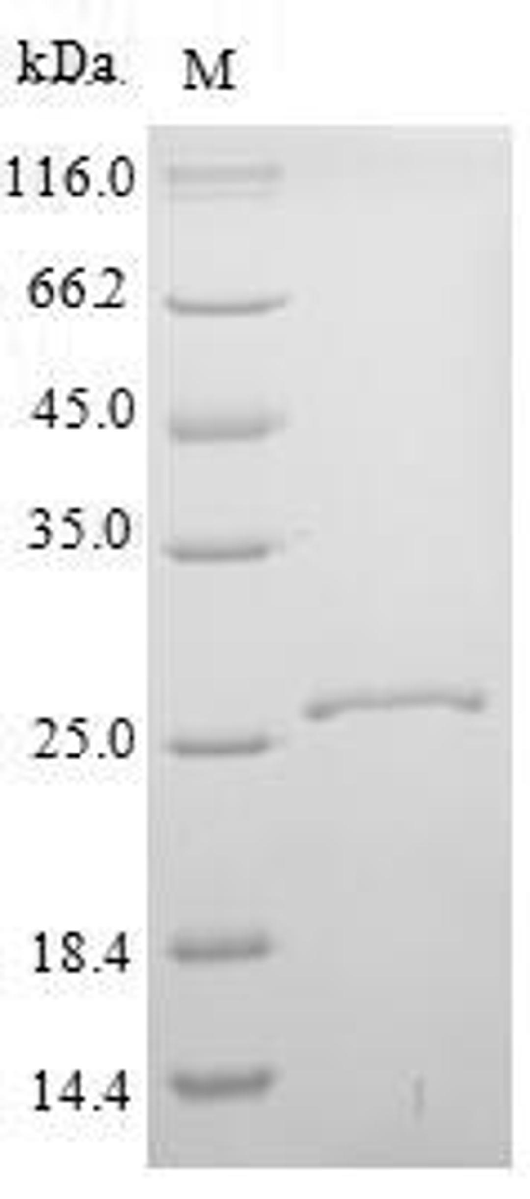 (Tris-Glycine gel) Discontinuous SDS-PAGE (reduced) with 5% enrichment gel and 15% separation gel.