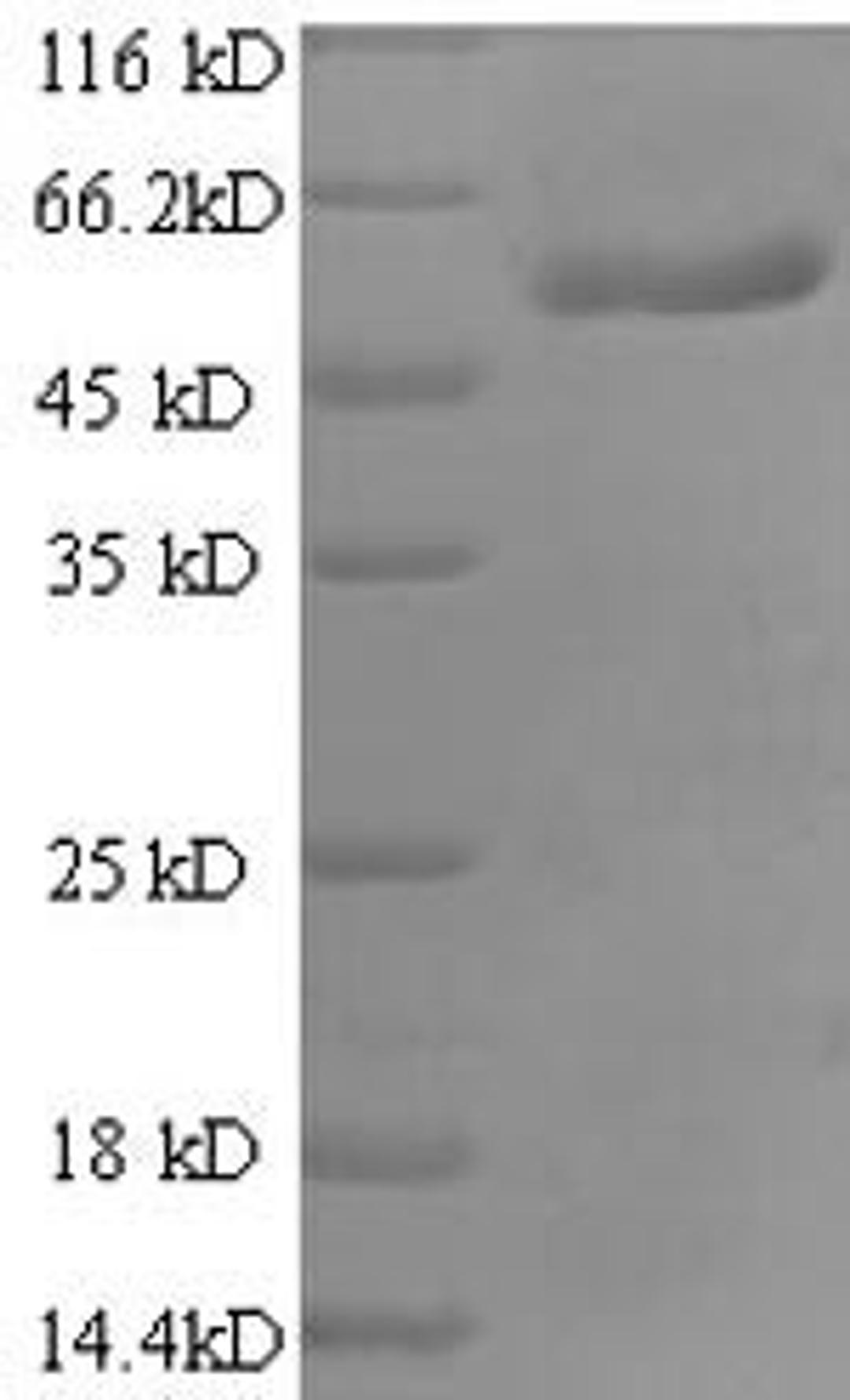(Tris-Glycine gel) Discontinuous SDS-PAGE (reduced) with 5% enrichment gel and 15% separation gel.