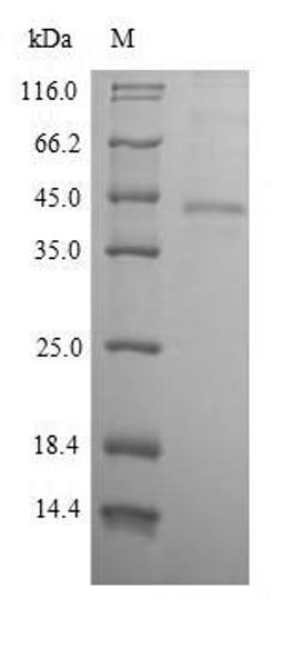 (Tris-Glycine gel) Discontinuous SDS-PAGE (reduced) with 5% enrichment gel and 15% separation gel.