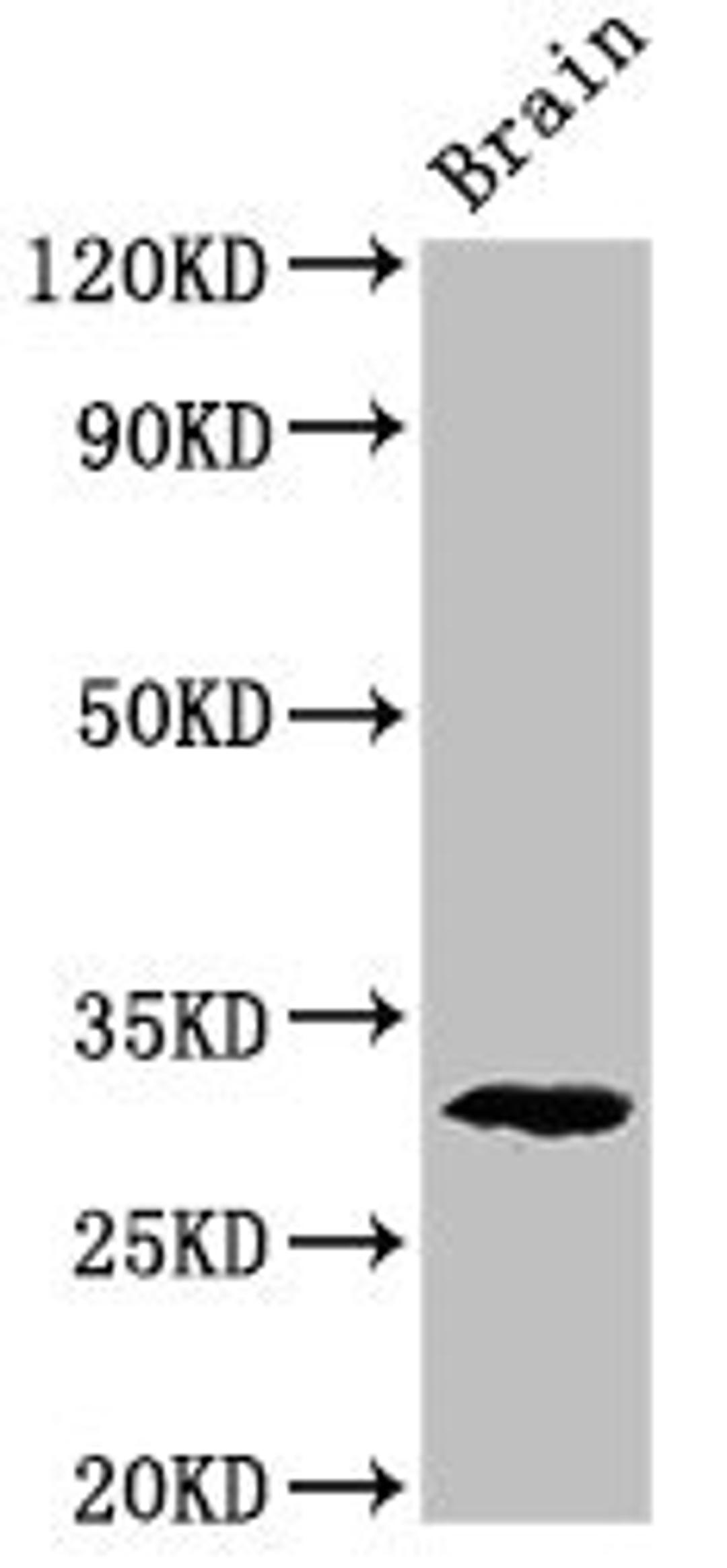 Western Blot. Positive WB detected in: Rat brain tissue. All lanes: Pdxp antibody at 2.8ug/ml. Secondary. Goat polyclonal to rabbit IgG at 1/50000 dilution. Predicted band size: 32 kDa. Observed band size: 32 kDa. 