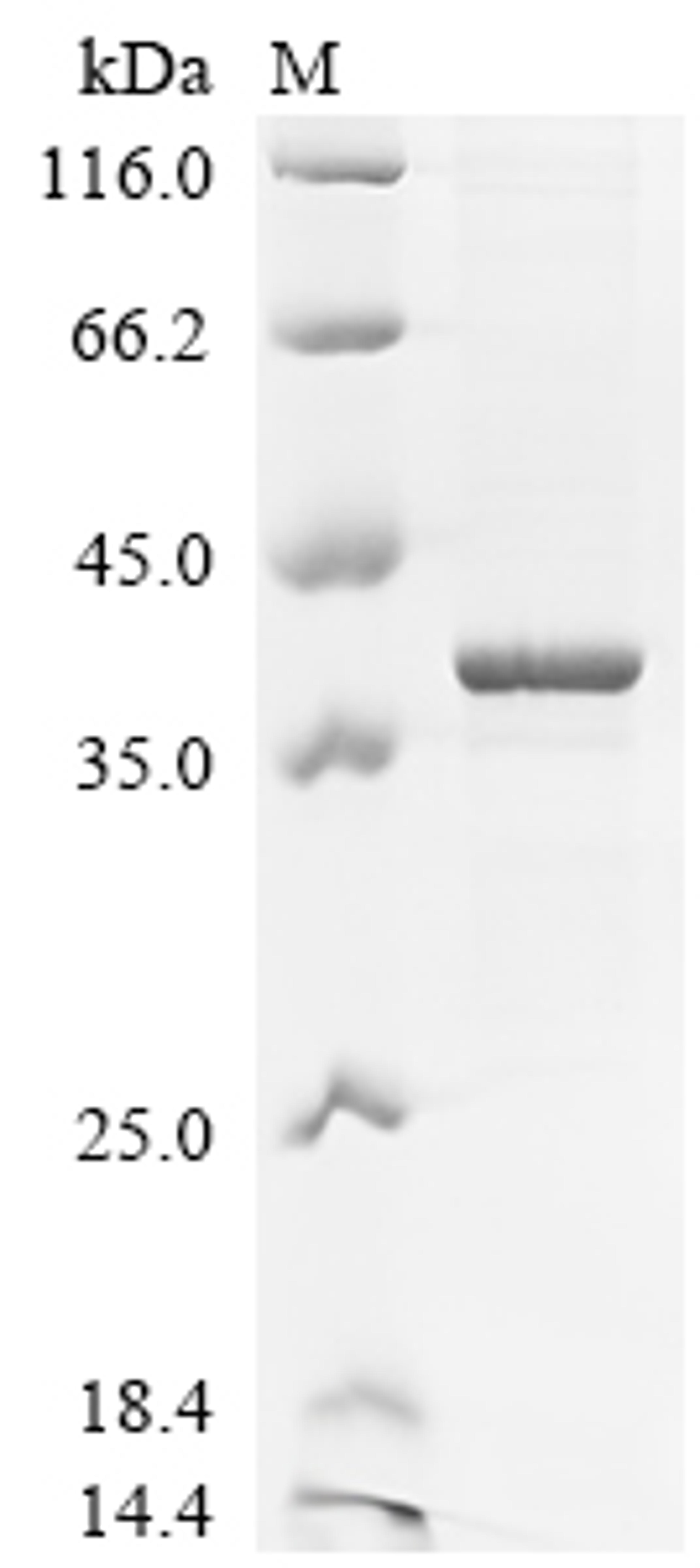 (Tris-Glycine gel) Discontinuous SDS-PAGE (reduced) with 5% enrichment gel and 15% separation gel.
