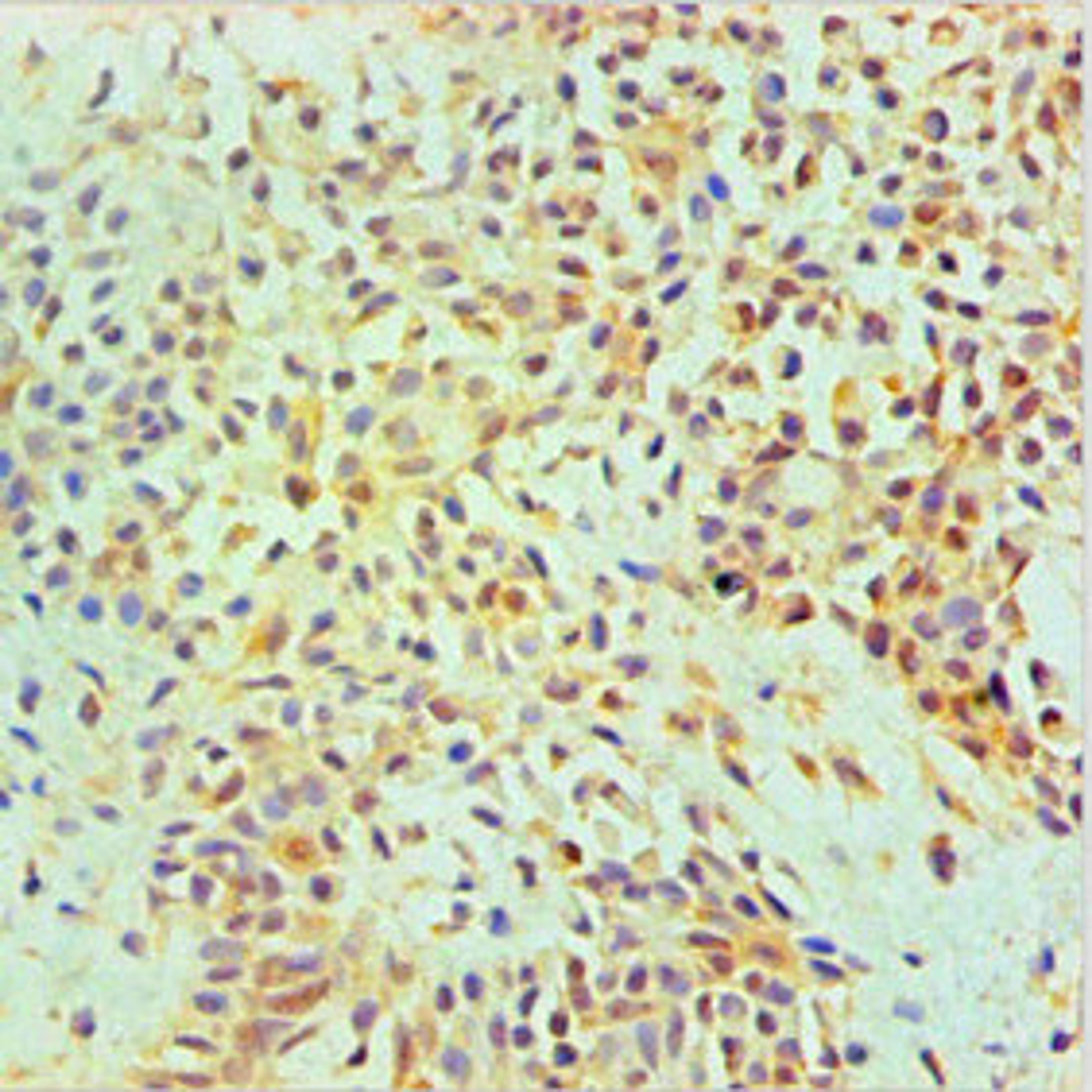 Immunohistochemical of paraffin-embedded Human Breast tissue using CSB-MA0106441A0m at dilution of 1:200.