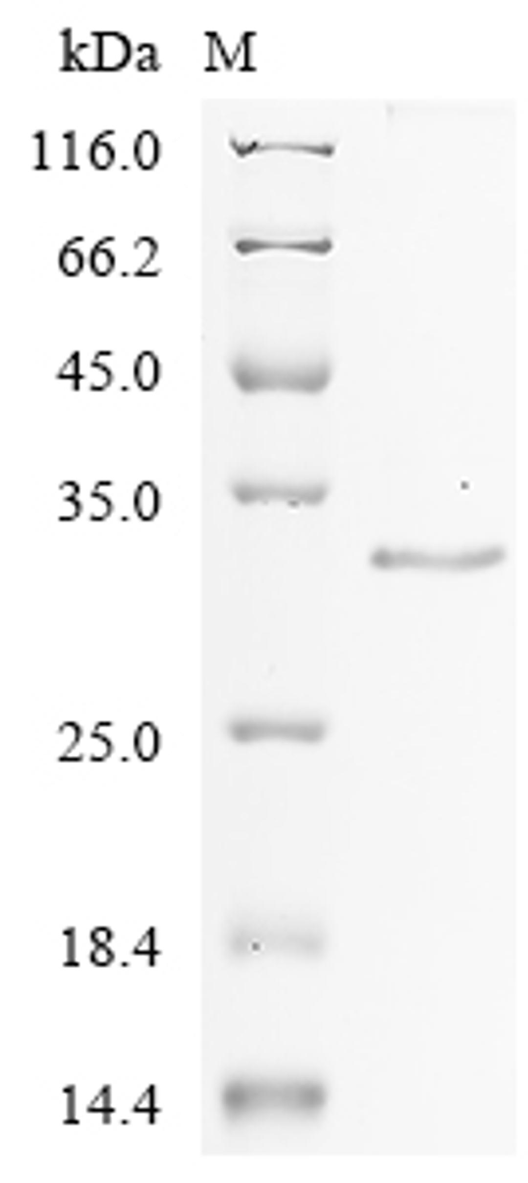 (Tris-Glycine gel) Discontinuous SDS-PAGE (reduced) with 5% enrichment gel and 15% separation gel.