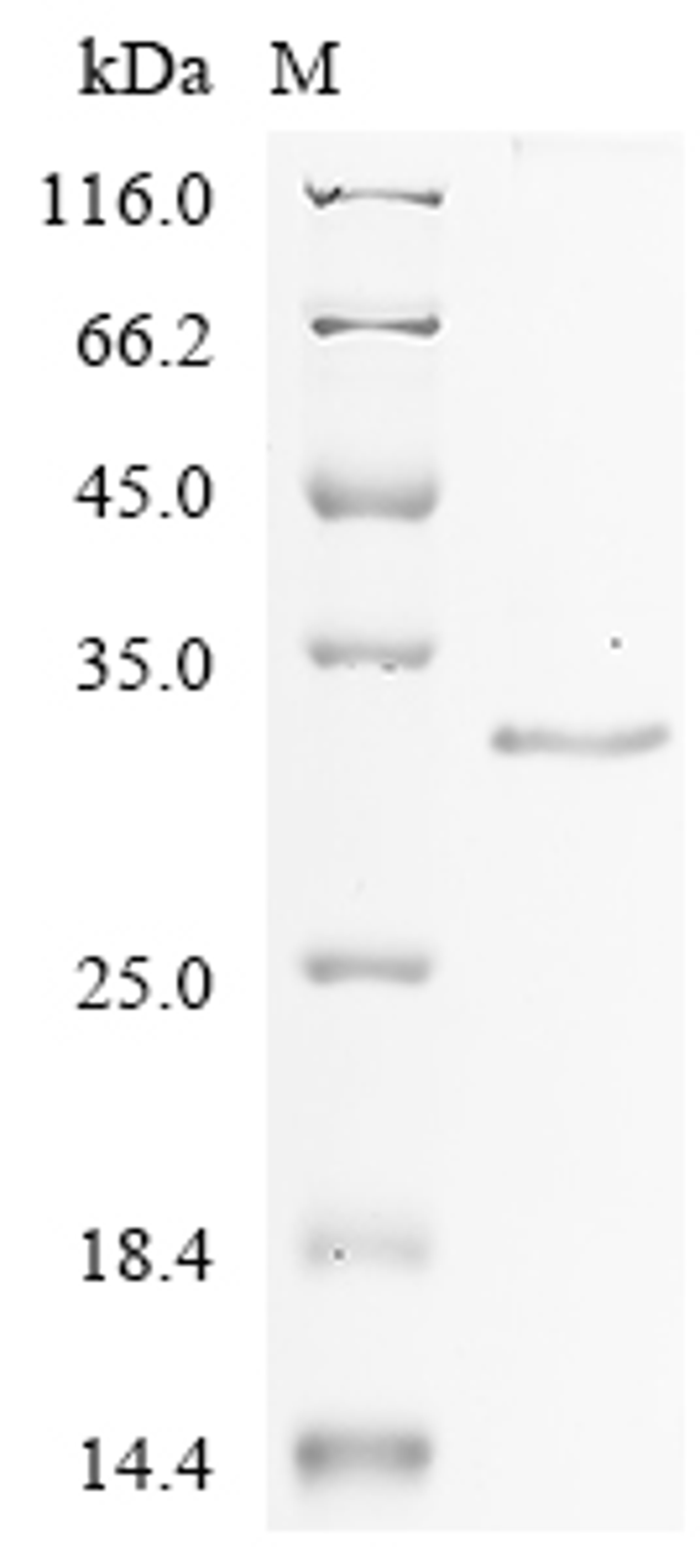 (Tris-Glycine gel) Discontinuous SDS-PAGE (reduced) with 5% enrichment gel and 15% separation gel.
