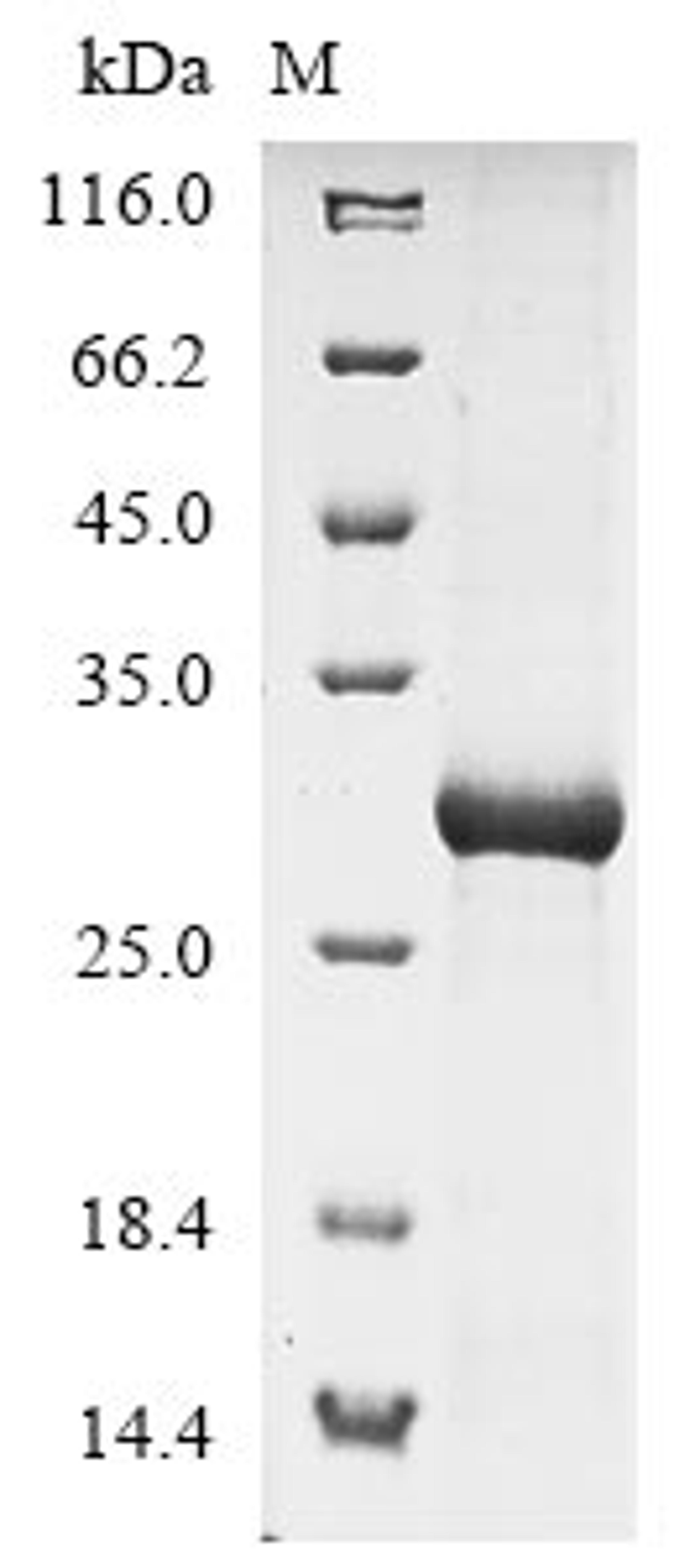 (Tris-Glycine gel) Discontinuous SDS-PAGE (reduced) with 5% enrichment gel and 15% separation gel.