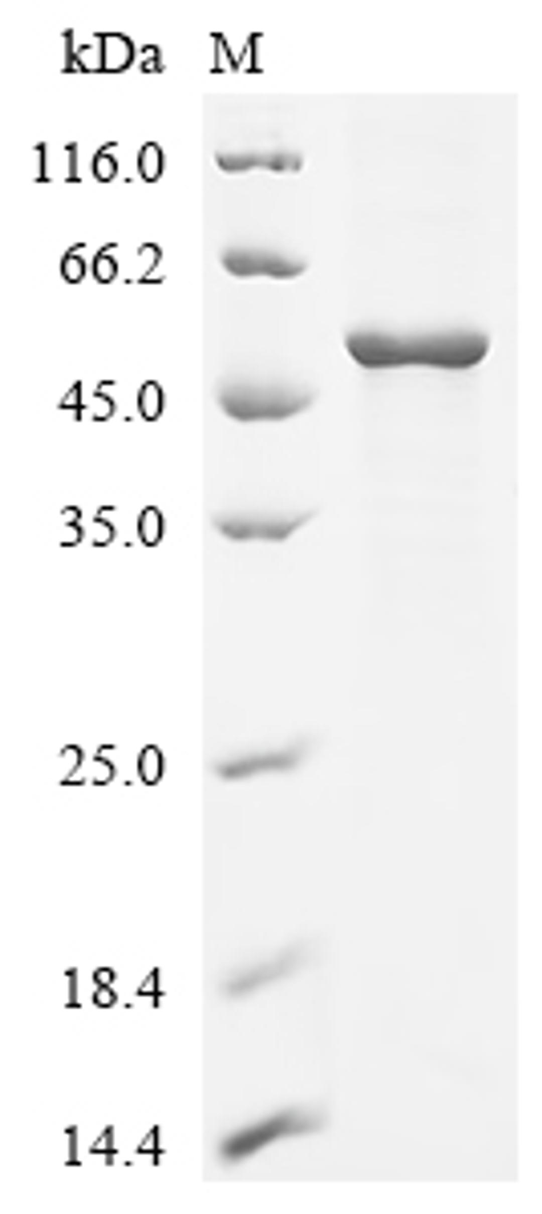 (Tris-Glycine gel) Discontinuous SDS-PAGE (reduced) with 5% enrichment gel and 15% separation gel.