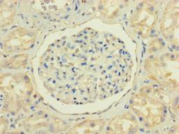 Immunohistochemistry of paraffin-embedded human kidney tissue using CSB-PA015976LA01HU at dilution of 1:100