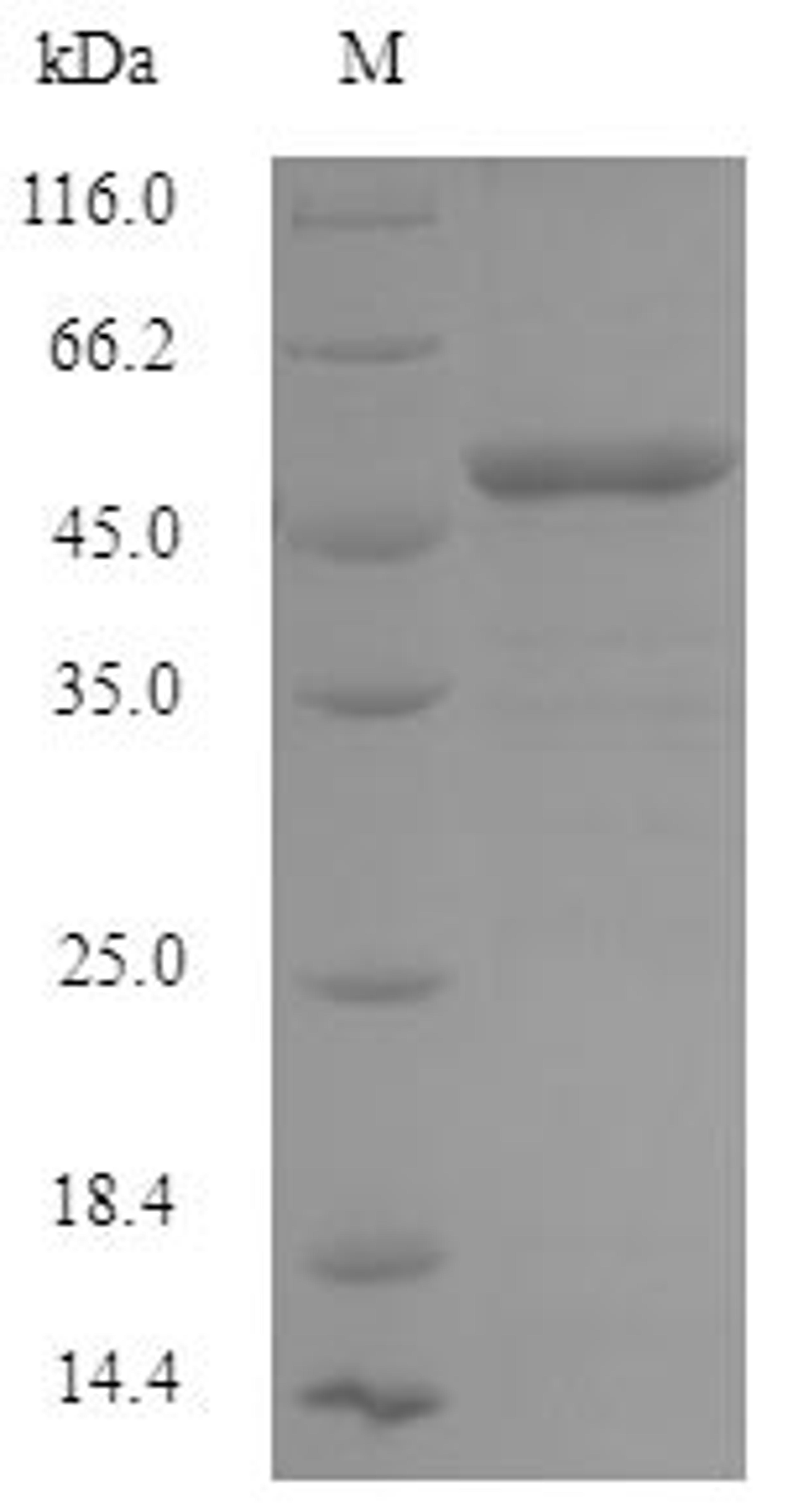 (Tris-Glycine gel) Discontinuous SDS-PAGE (reduced) with 5% enrichment gel and 15% separation gel.