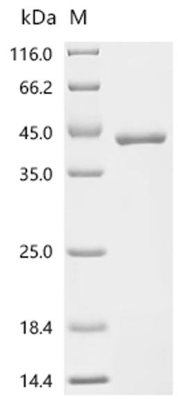 (Tris-Glycine gel) Discontinuous SDS-PAGE (reduced) with 5% enrichment gel and 15% separation gel.